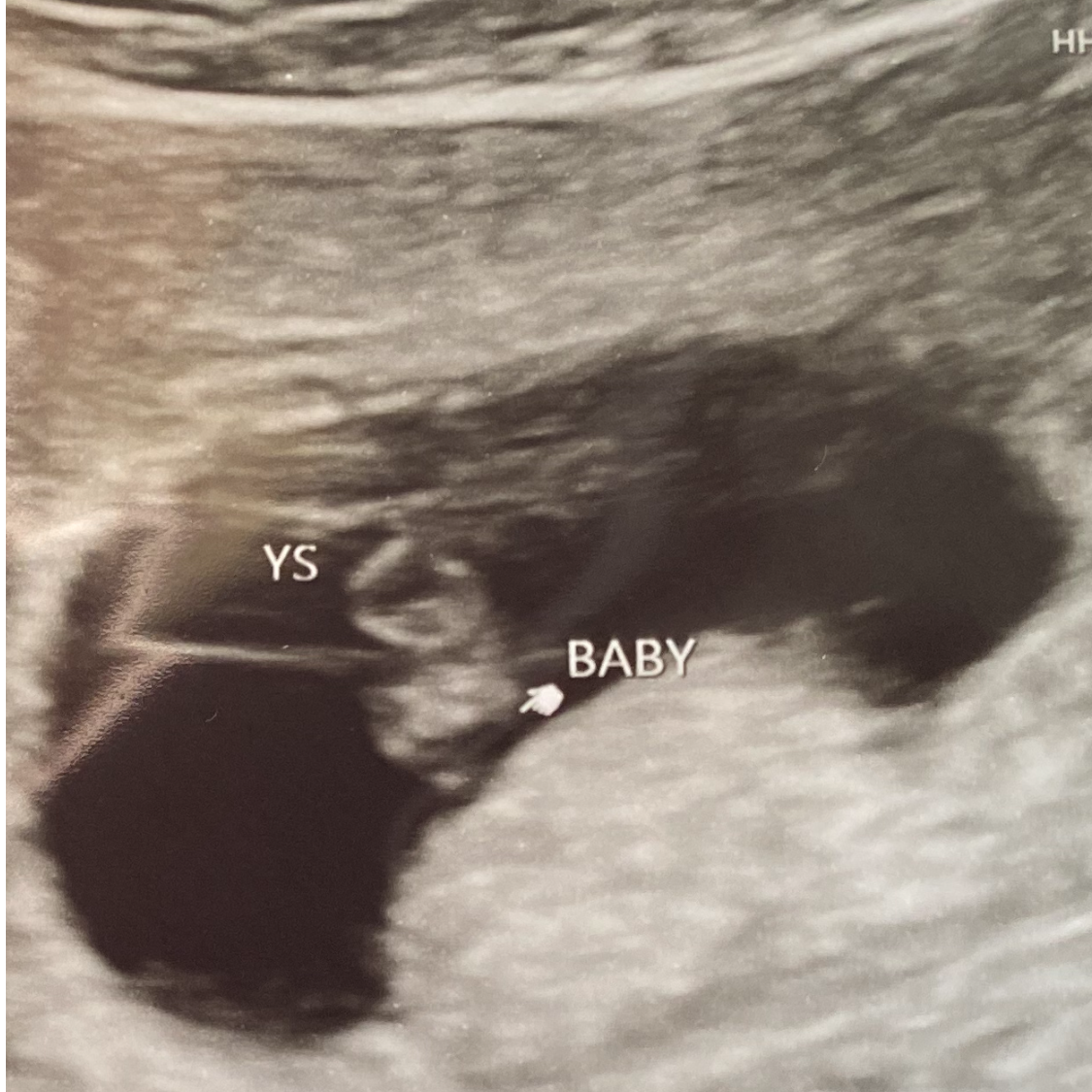Baby Flatow actual first picture - 5/24/21