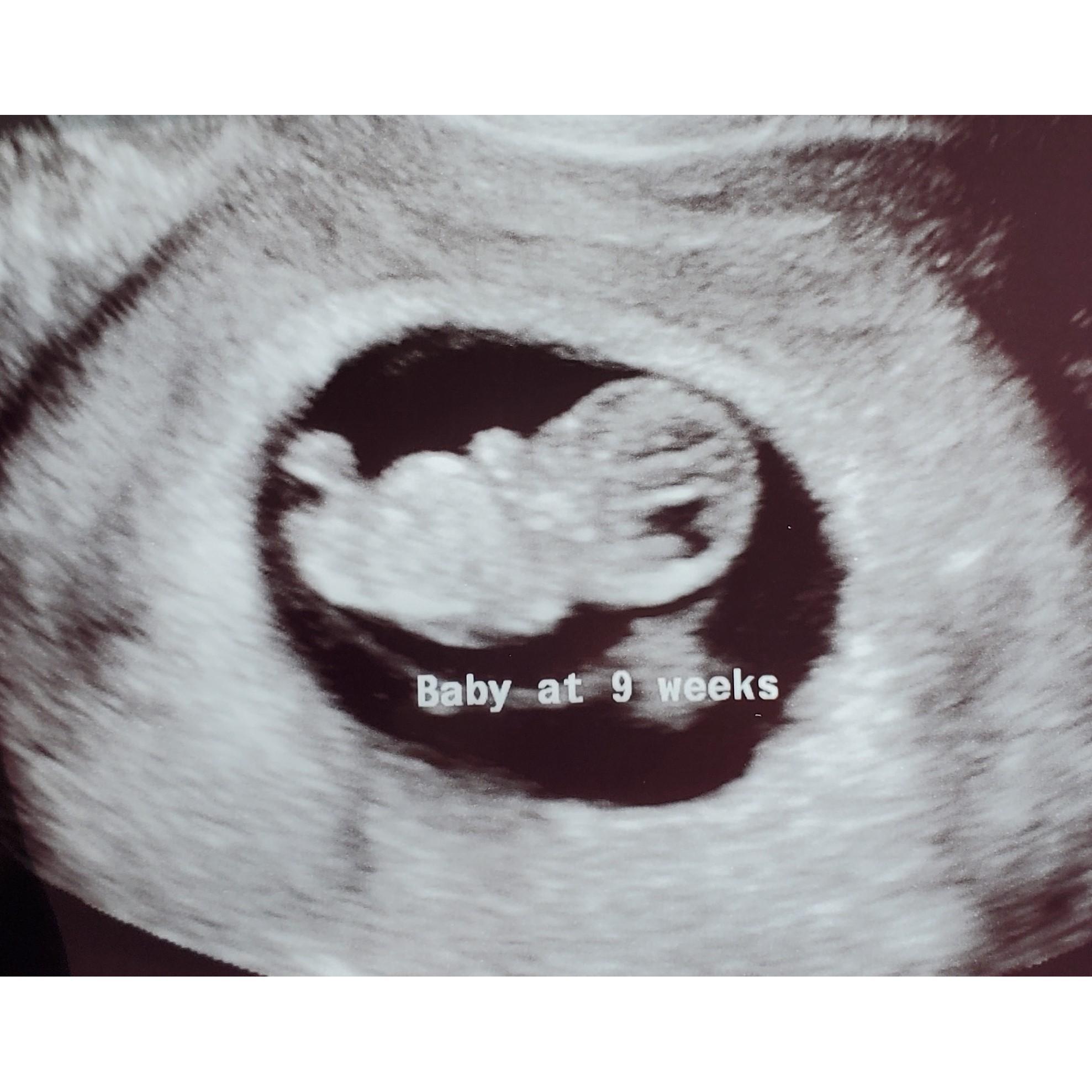 9 week ultrasound!
