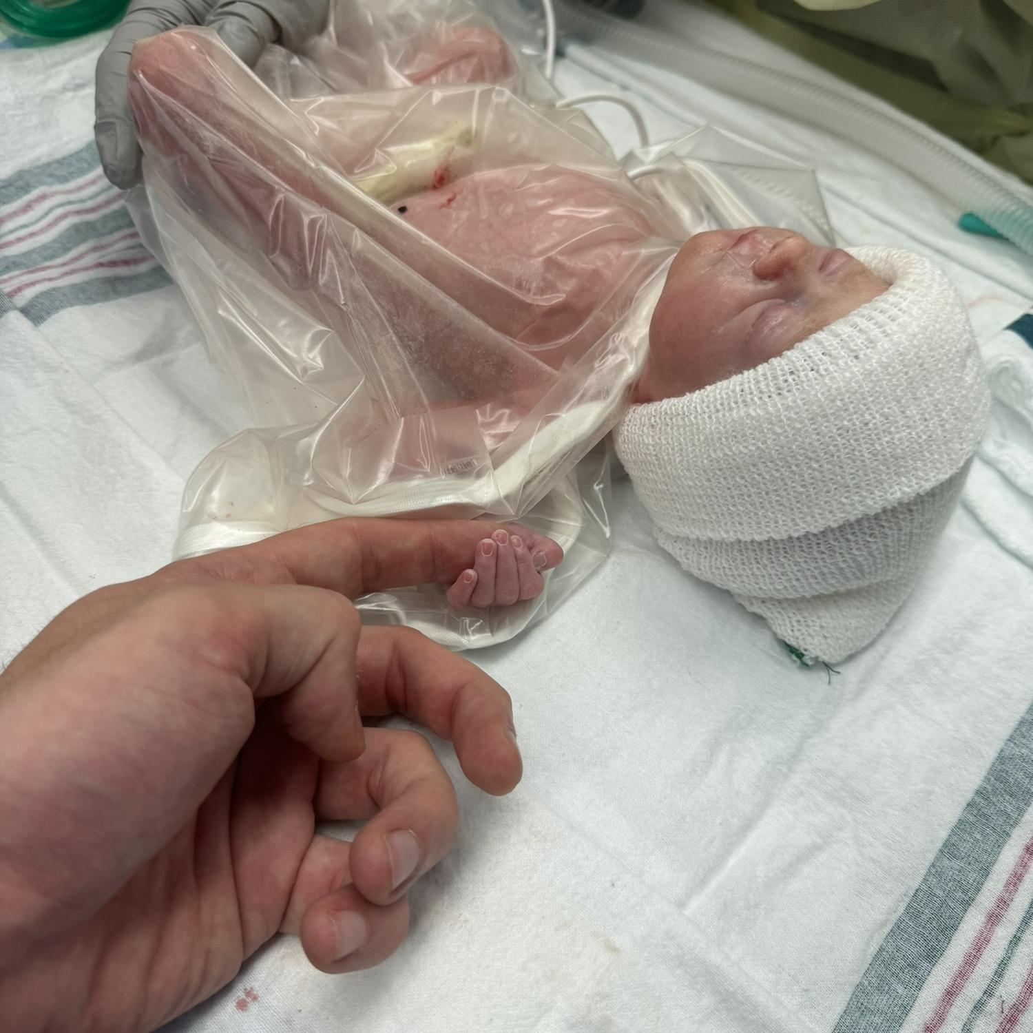Its a Girl!