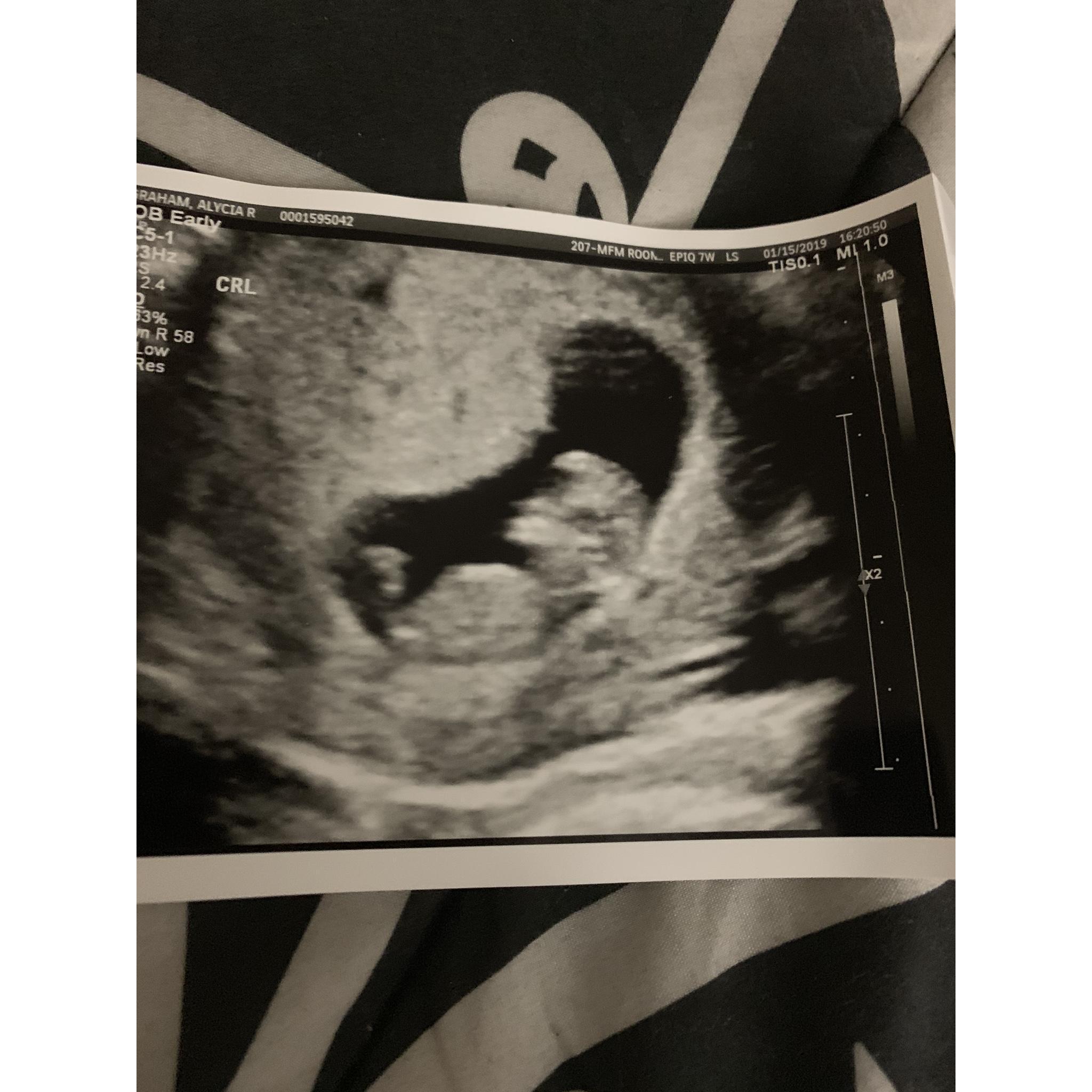 One of our first baby pics