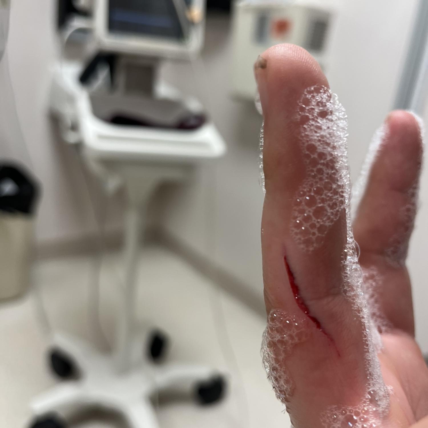 Later in 2023 when the groom cut open his finger and the bride accompanied him to the ER and pretended to be his girlfriend so the receptionist wouldn’t flirt with him.