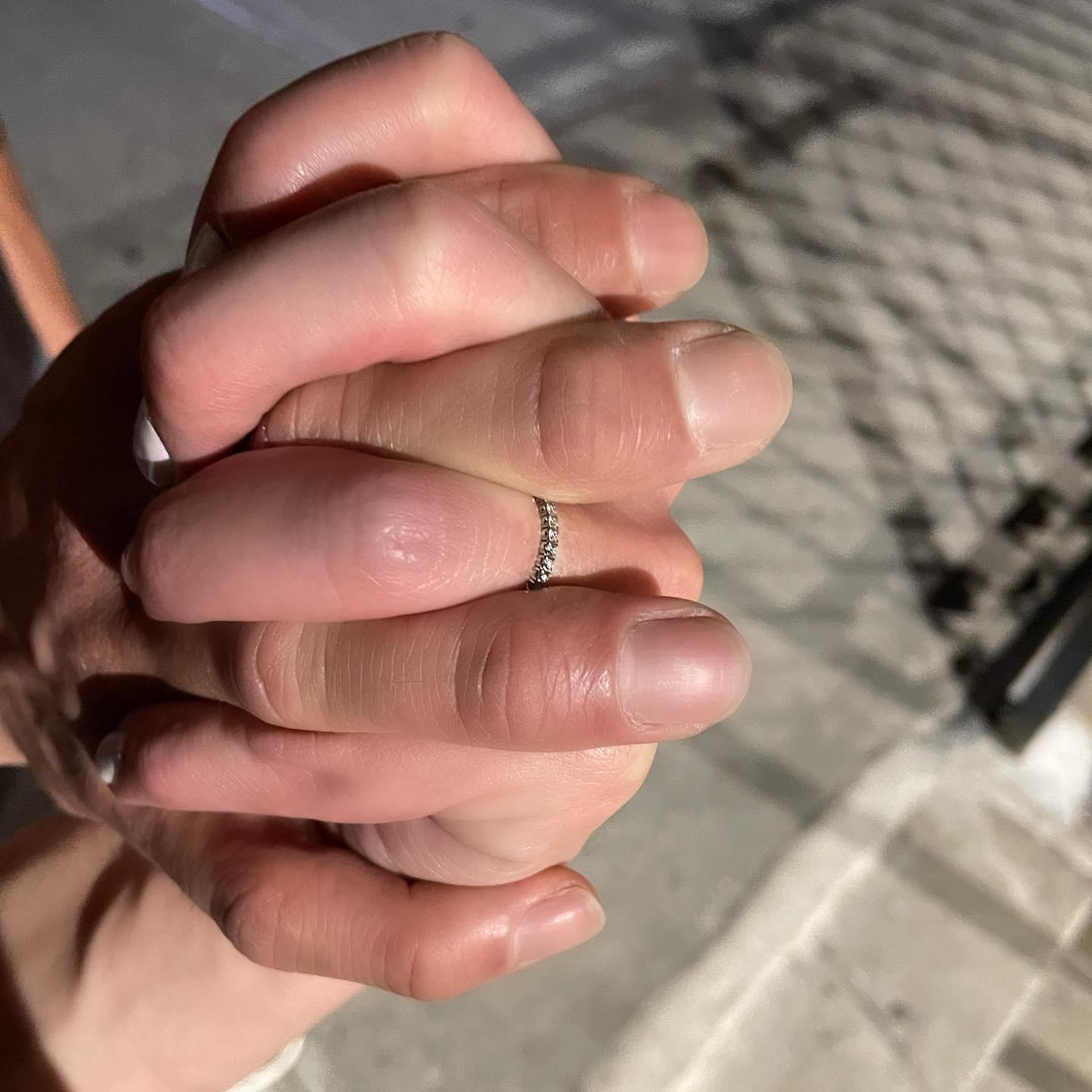 Clasping hands, my ring popping out