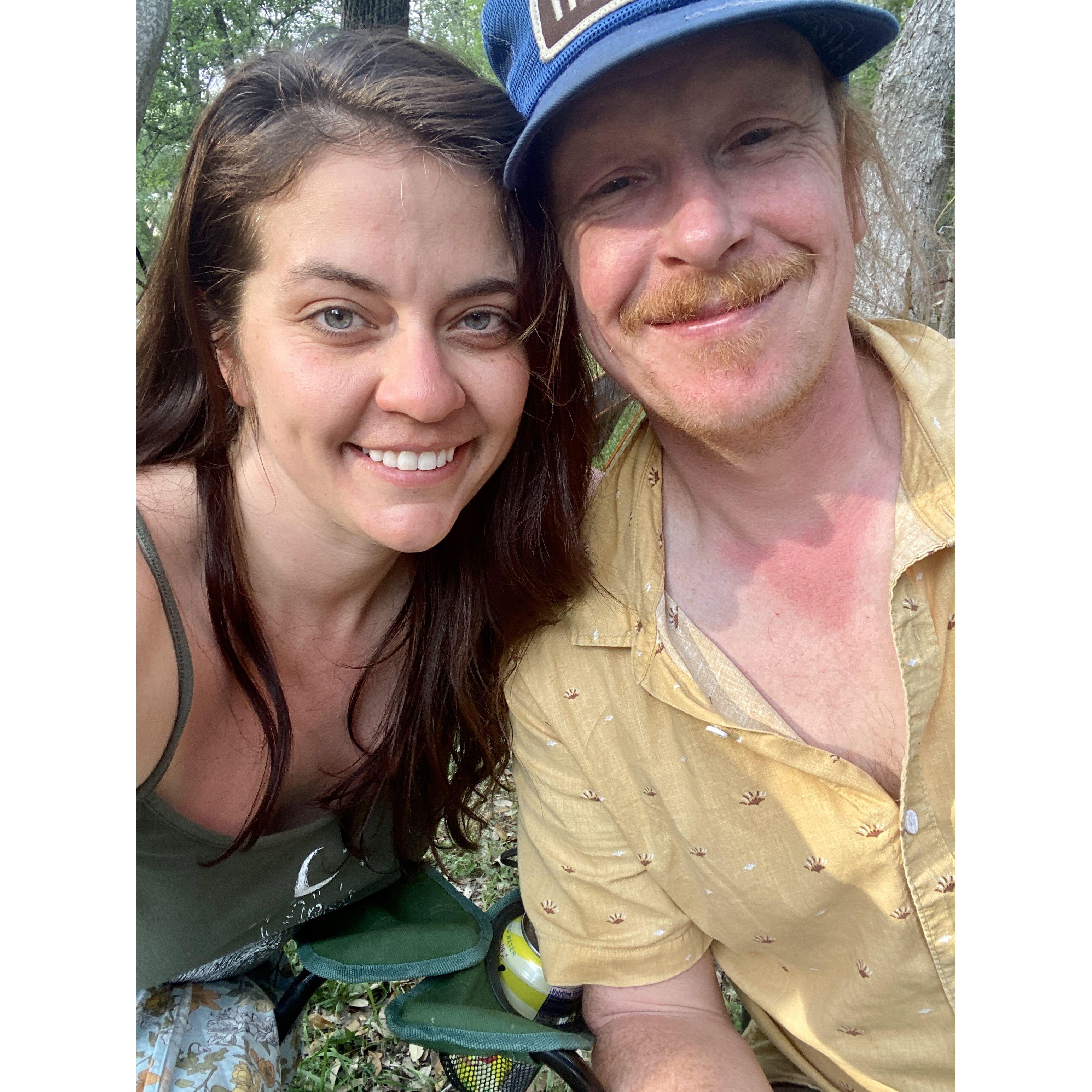 Sunburned at The Woodzie