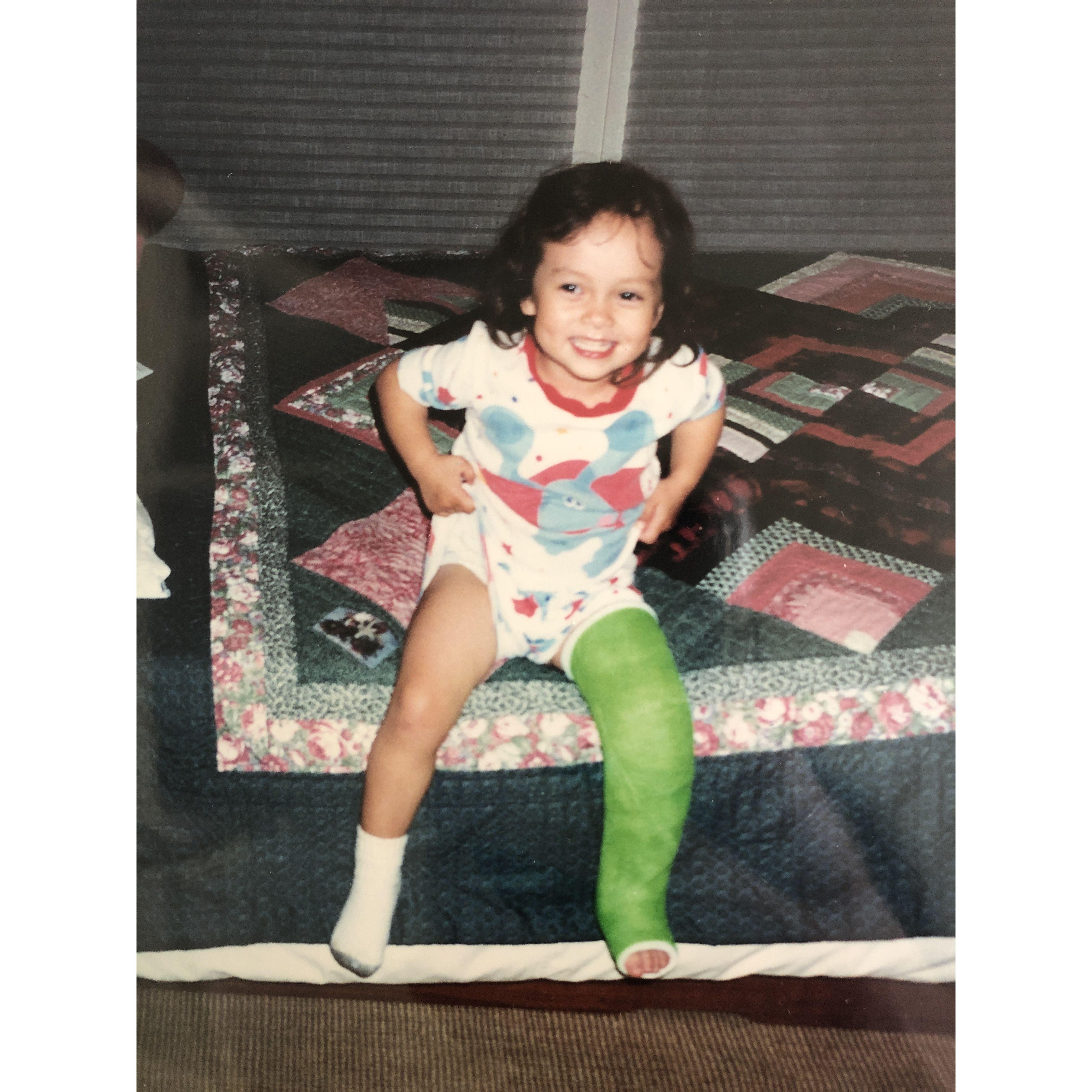 Natalie with a broken leg, age 3.