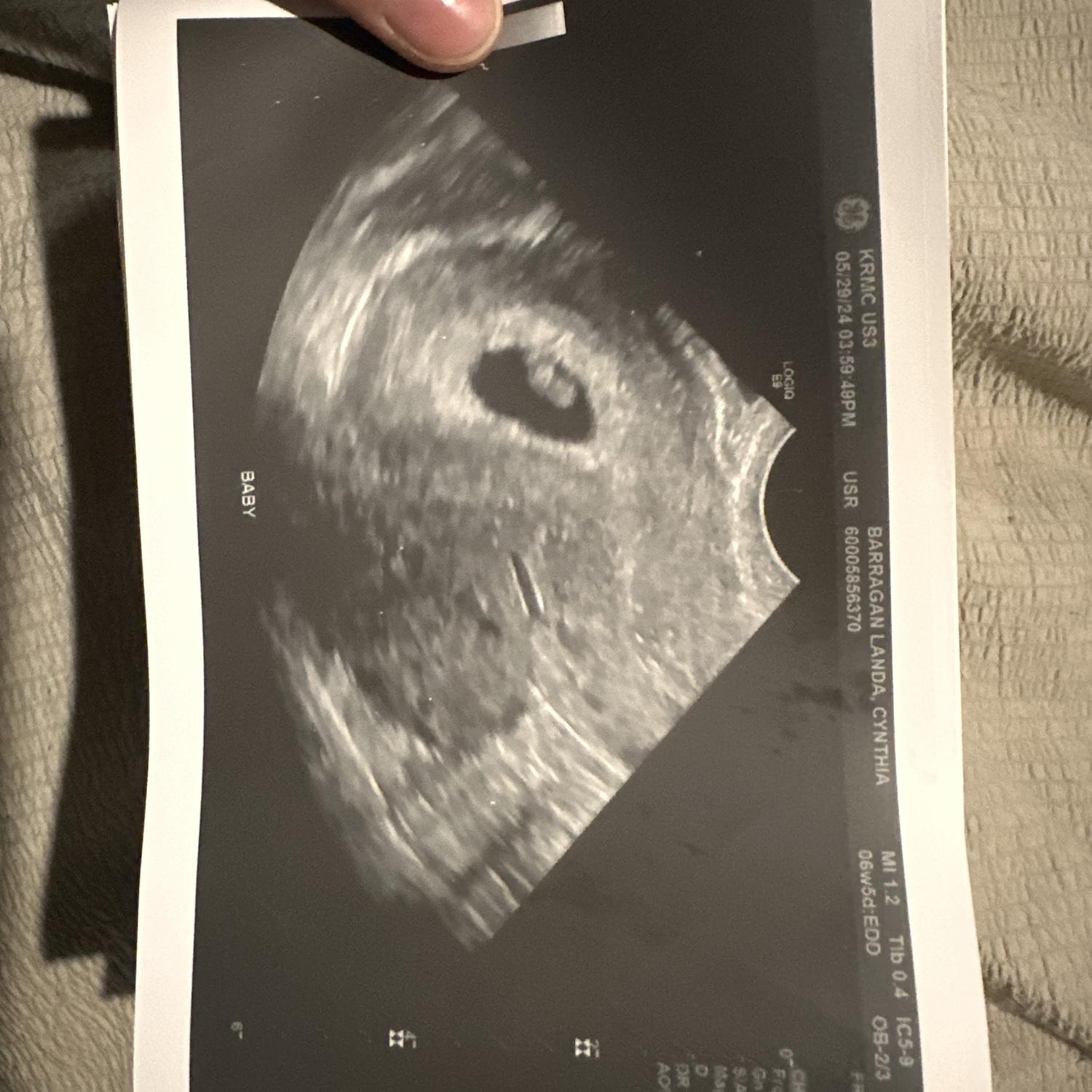 Baby (May 2024)