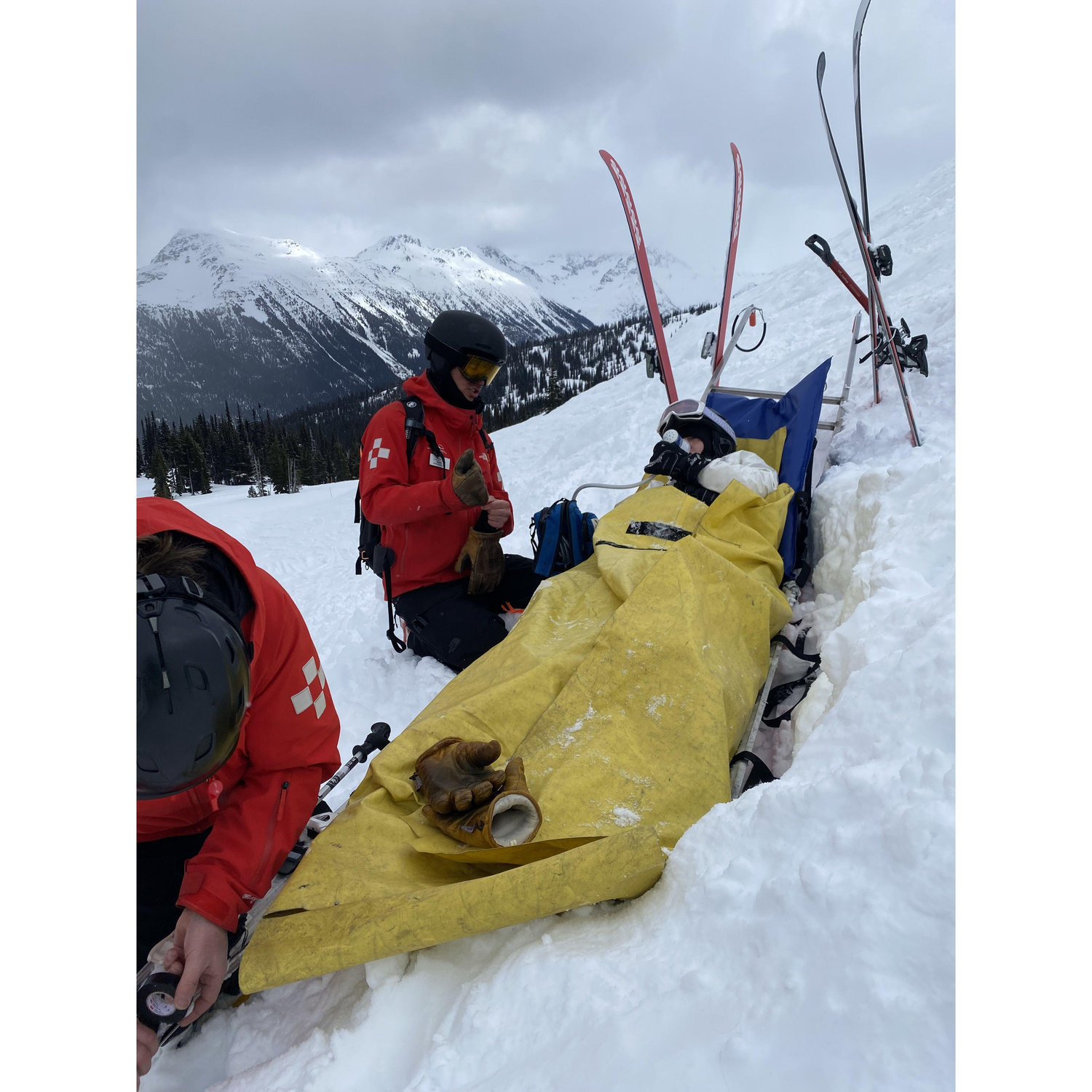 Thomas literally climbed a mountain to save Meg when she tore her ACL