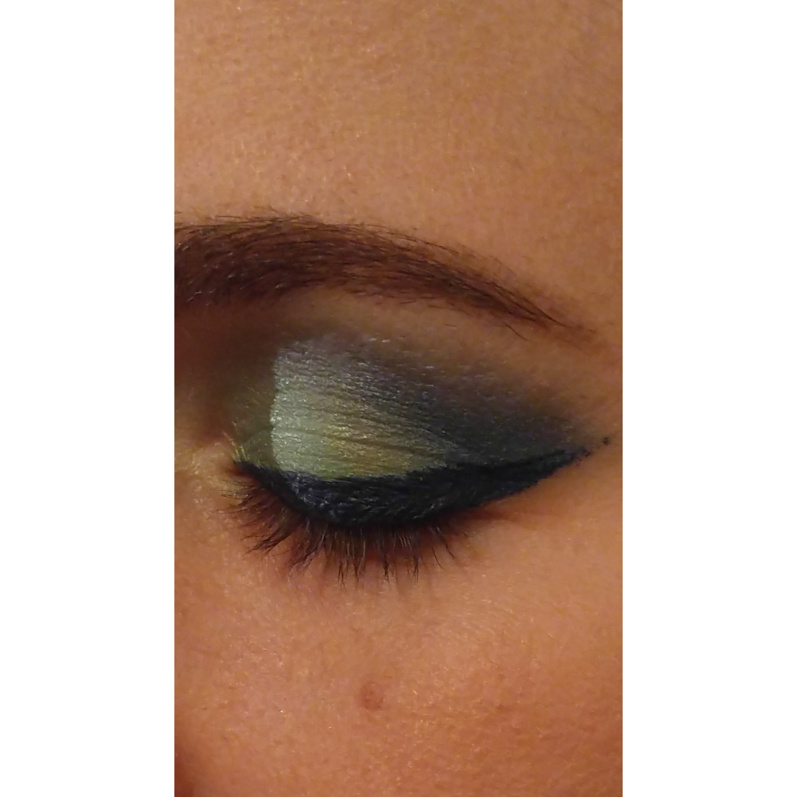 Dana's eye