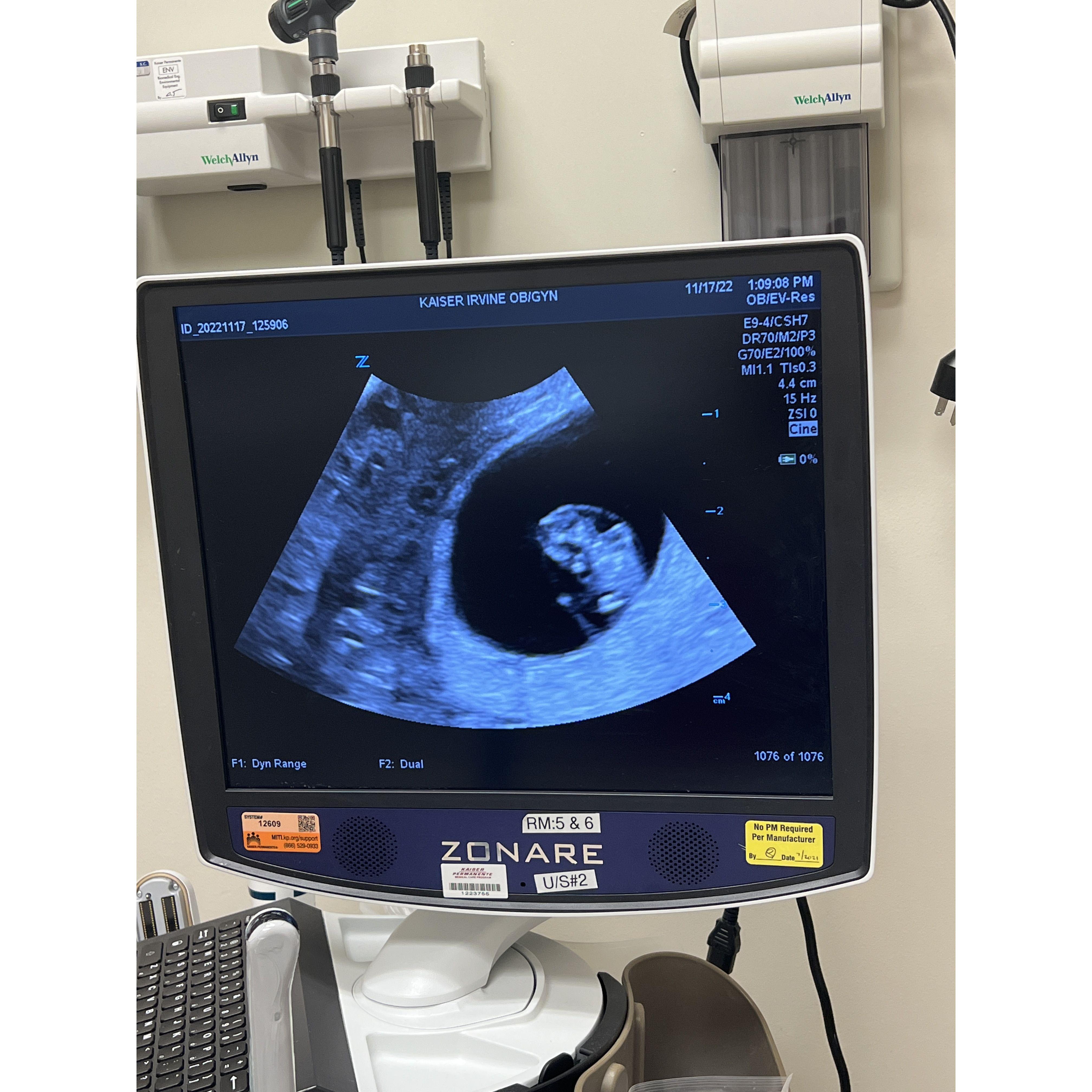 Definitely a surprise blessing that we never knew we needed.