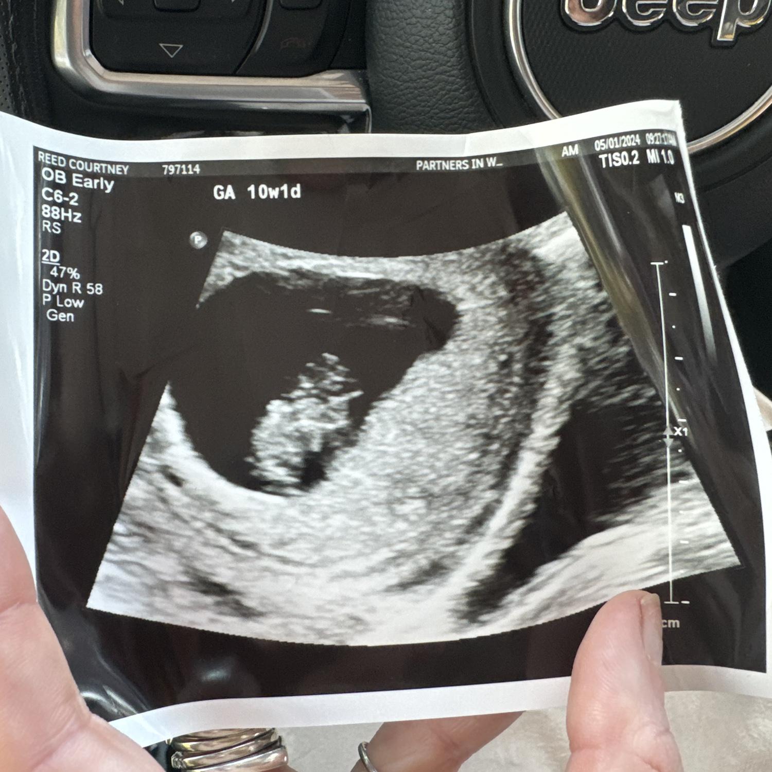 Baby Casey 10 weeks