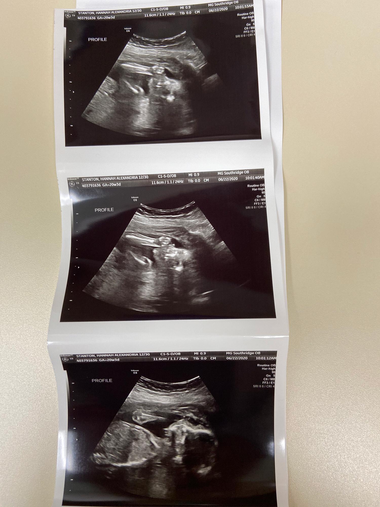Baby Hazel Jane Pulley