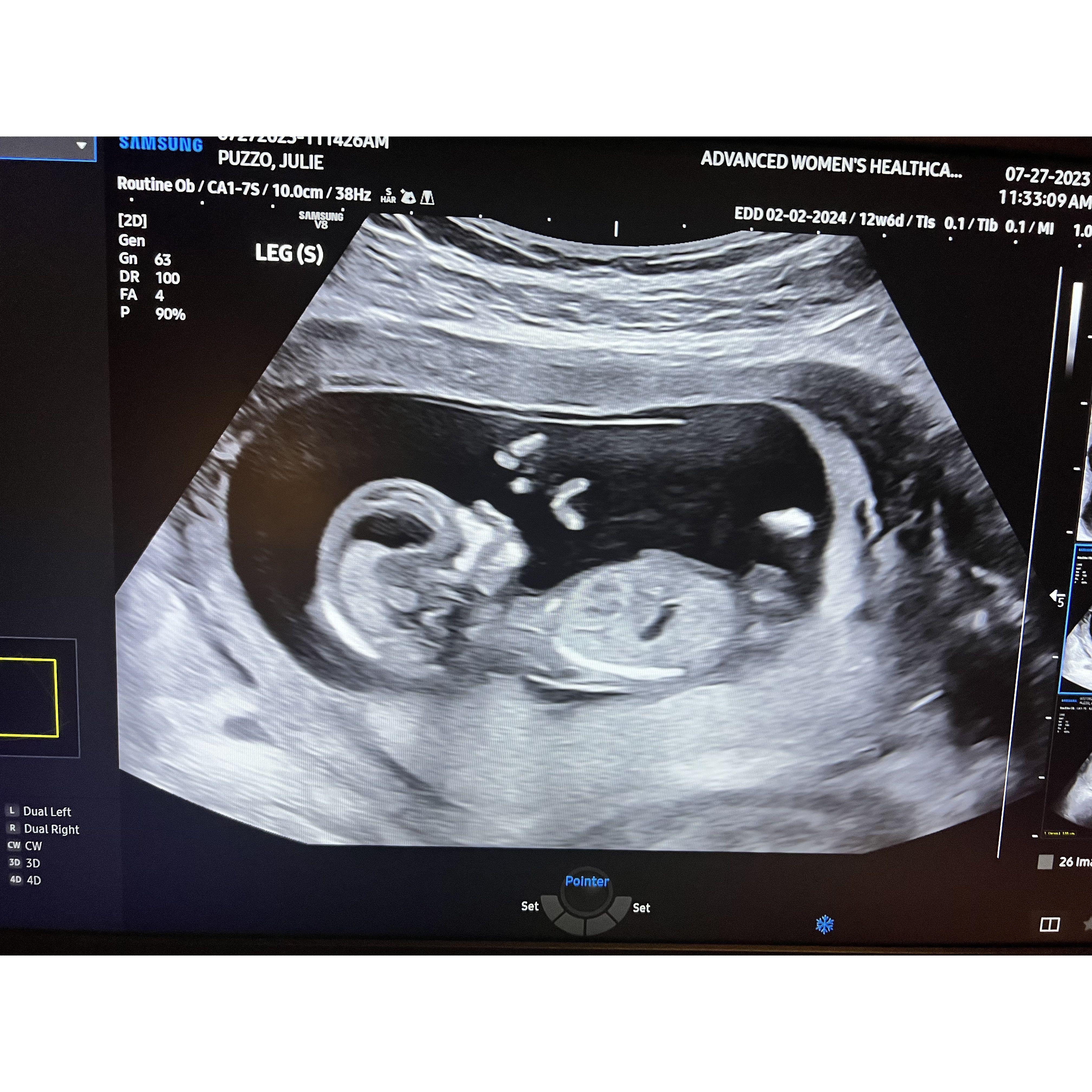 Silly baby hands