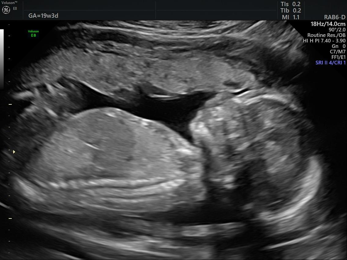 Little one!