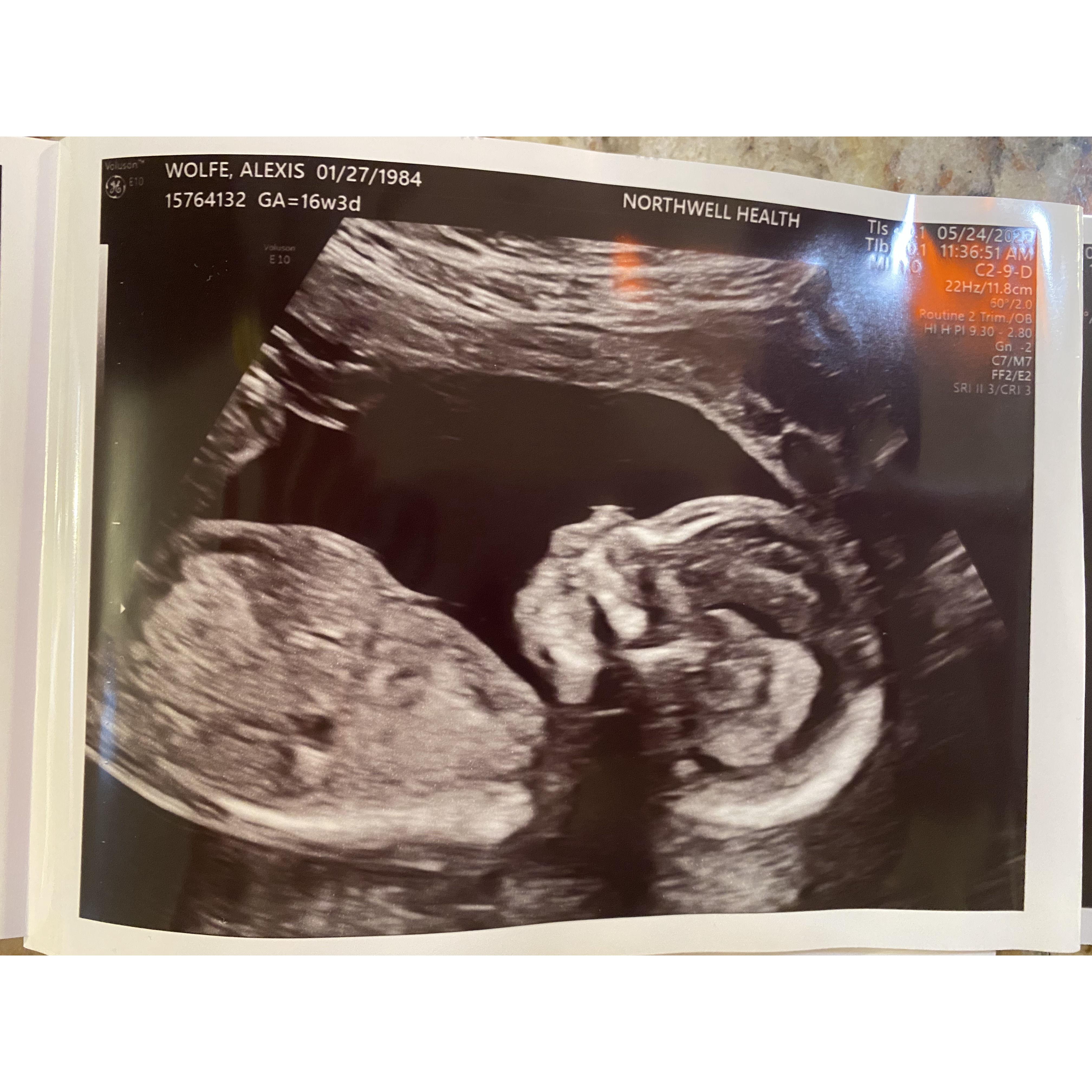 Future baby Lucas : )