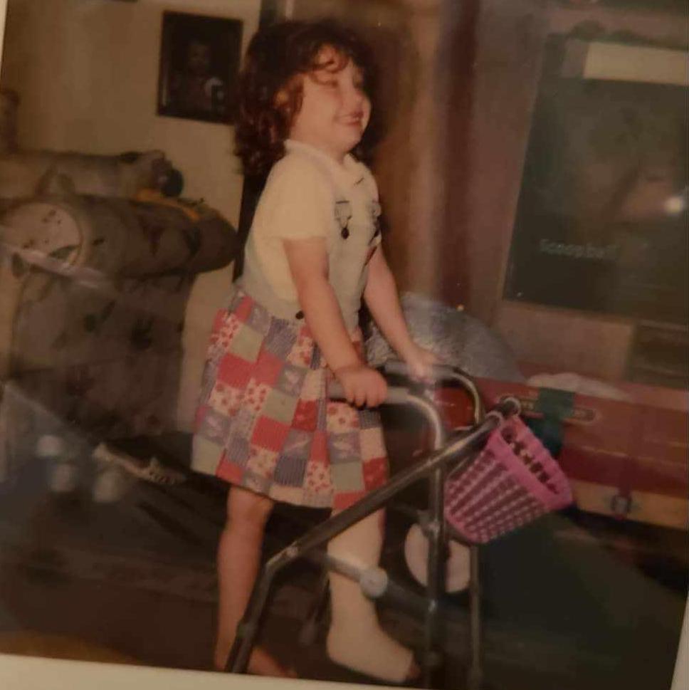 Kylee and her broken leg, 2000 (aged 4)