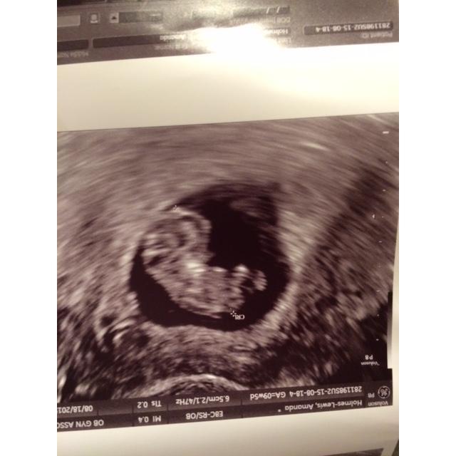 Tiny baby Charlie :)