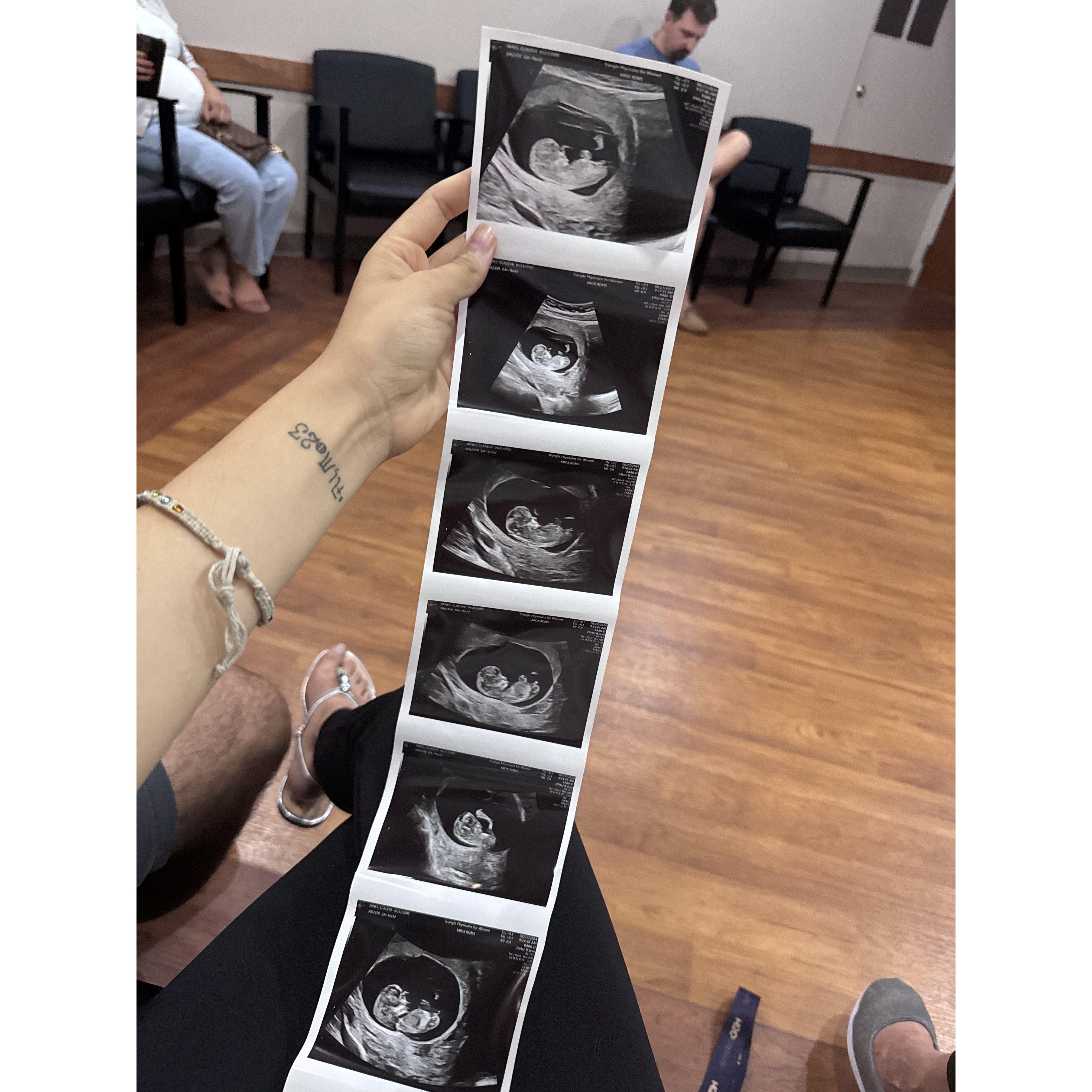 Rachel's first ultrasound