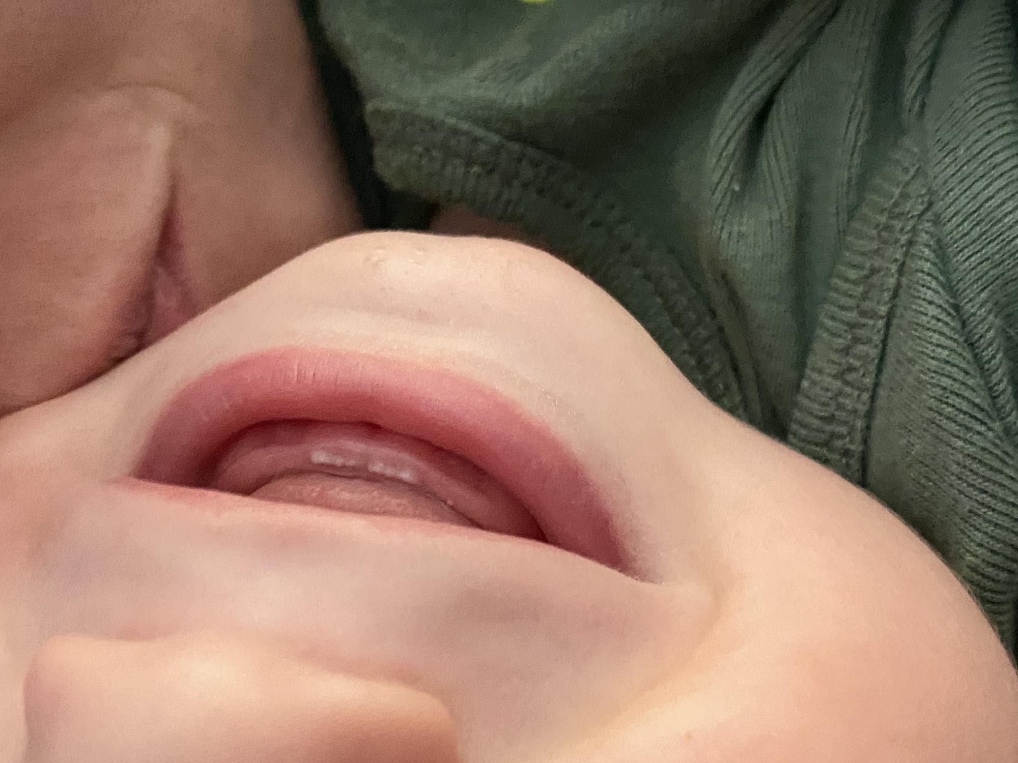 First Teeth!