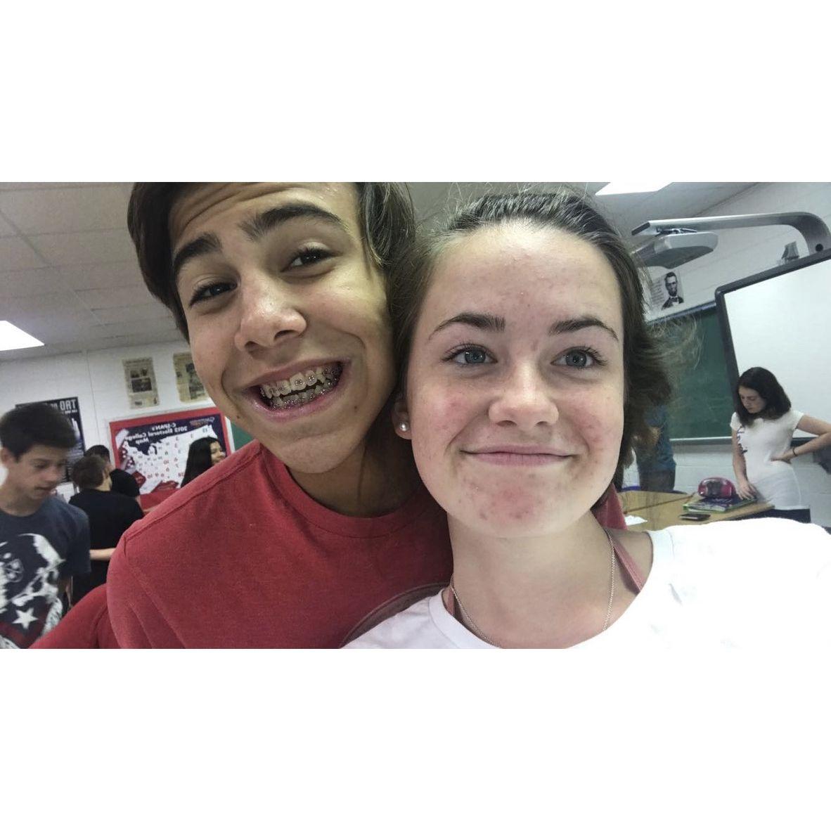 The day he got braces!