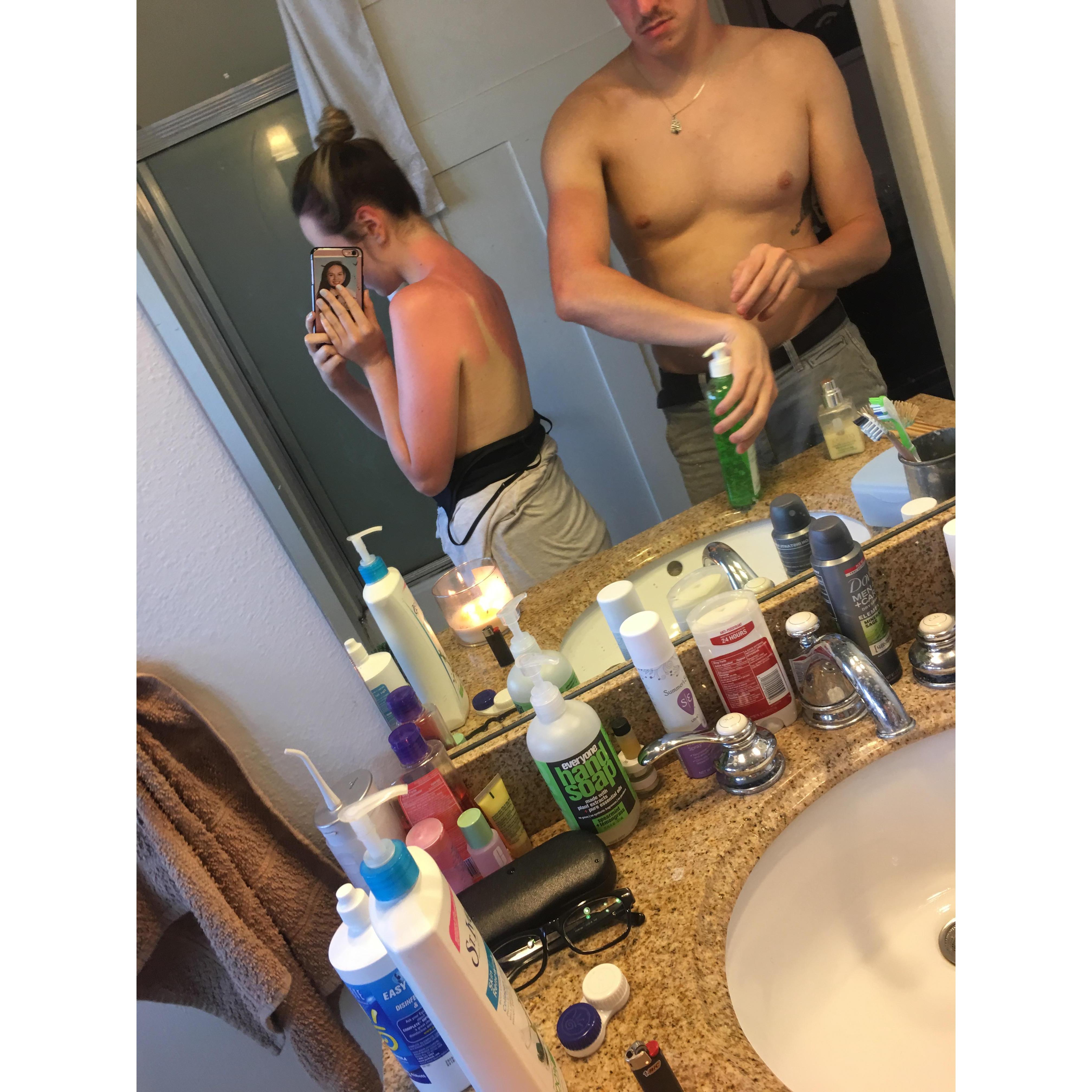 And we got more than sunburnt