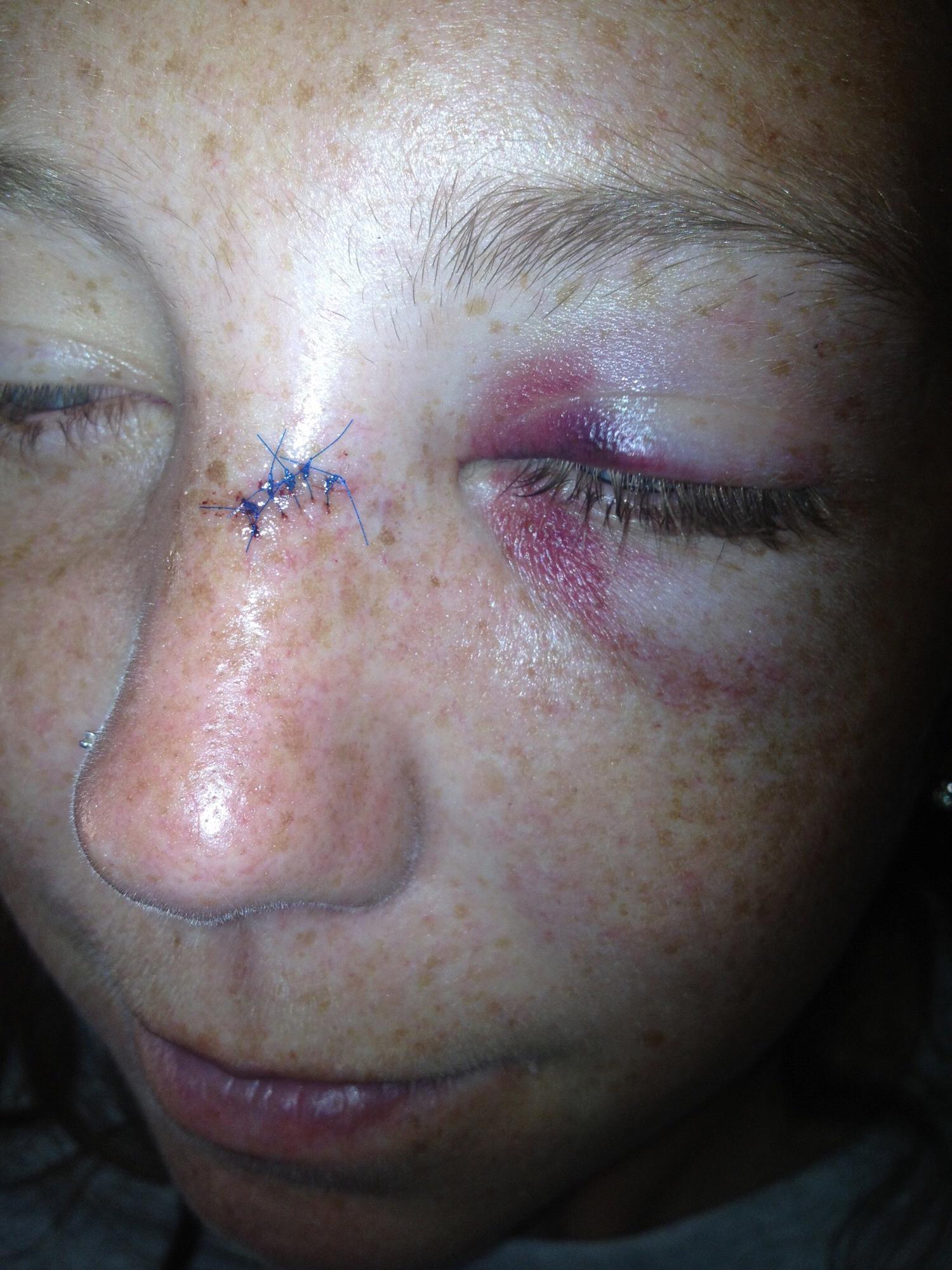 The results of tubing
