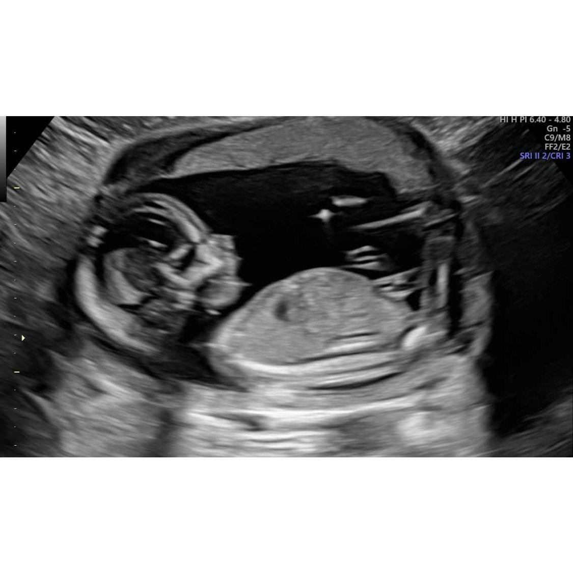 Baby coming soon!