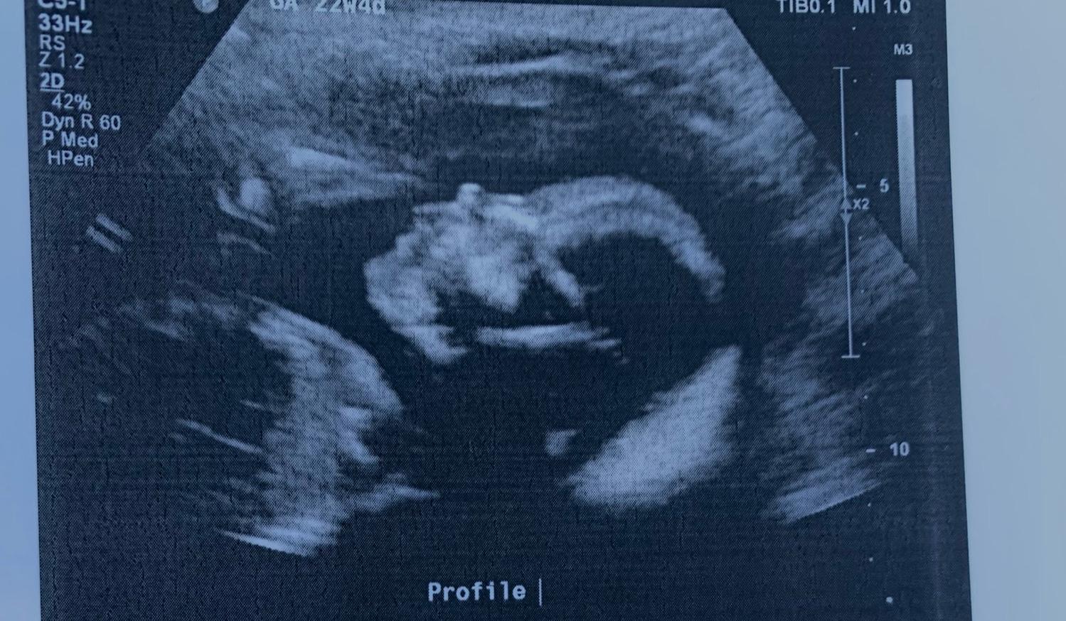 934b46bf-08f6-4c97-8e78-55474ad1a2ca