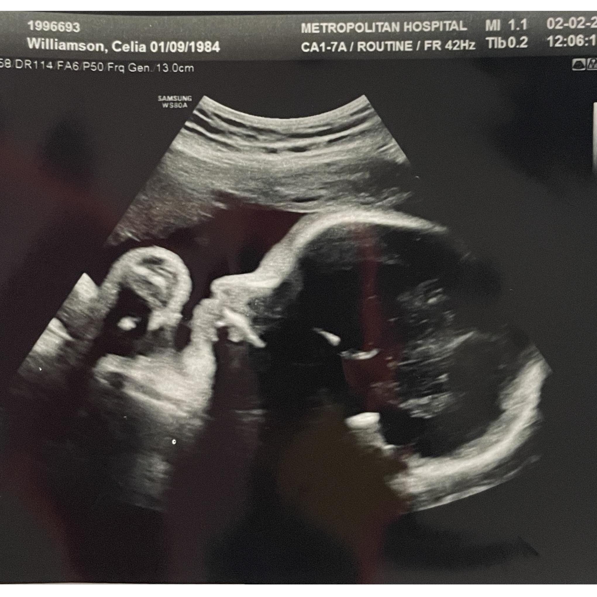 33 Weeks