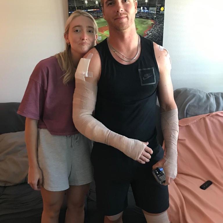 After his motorcycle accident… he’s so brave and strong!
