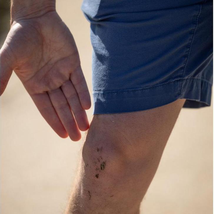Wes still had dirt on his knee from when he knelt down!