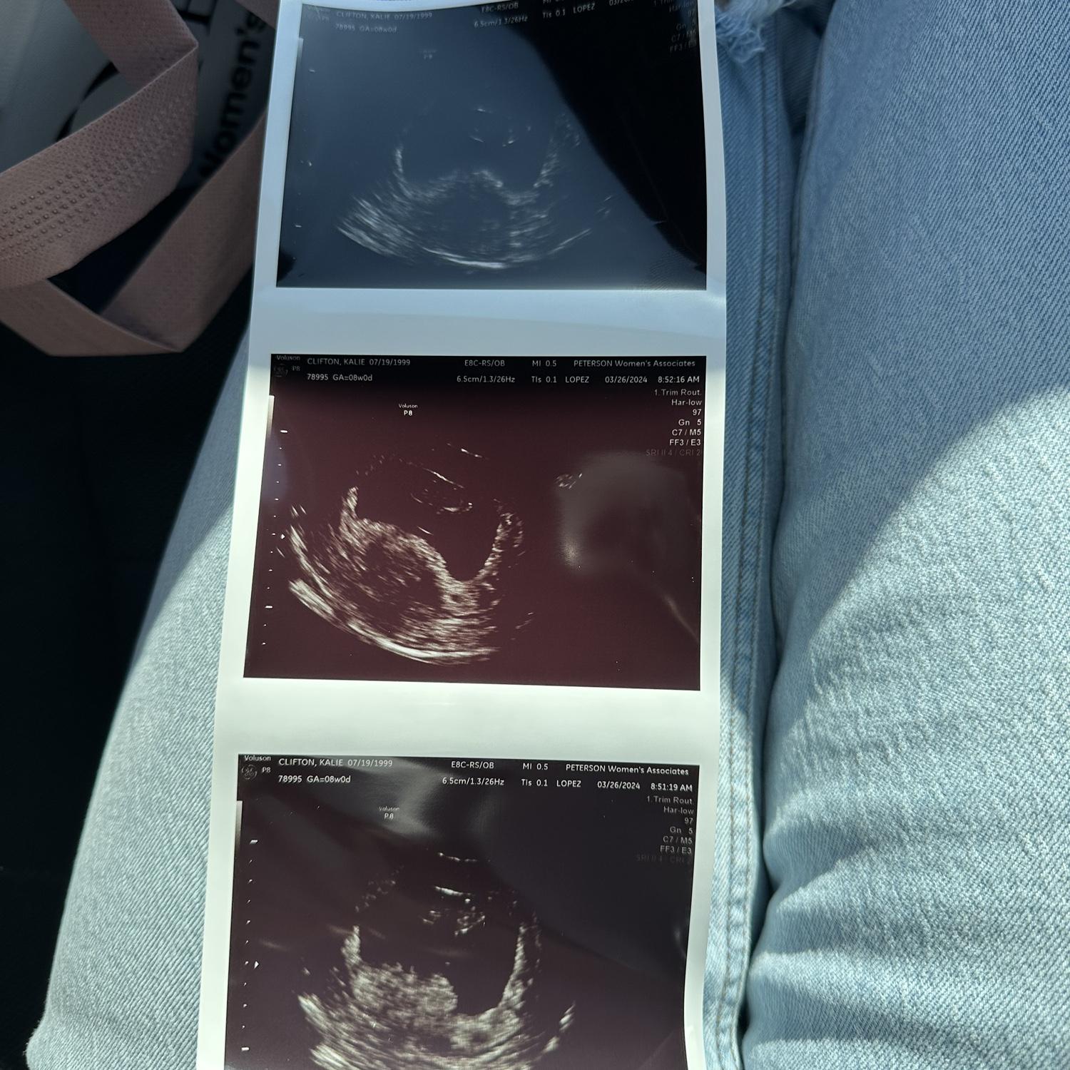 Found out we’re going to be PARENTS!!