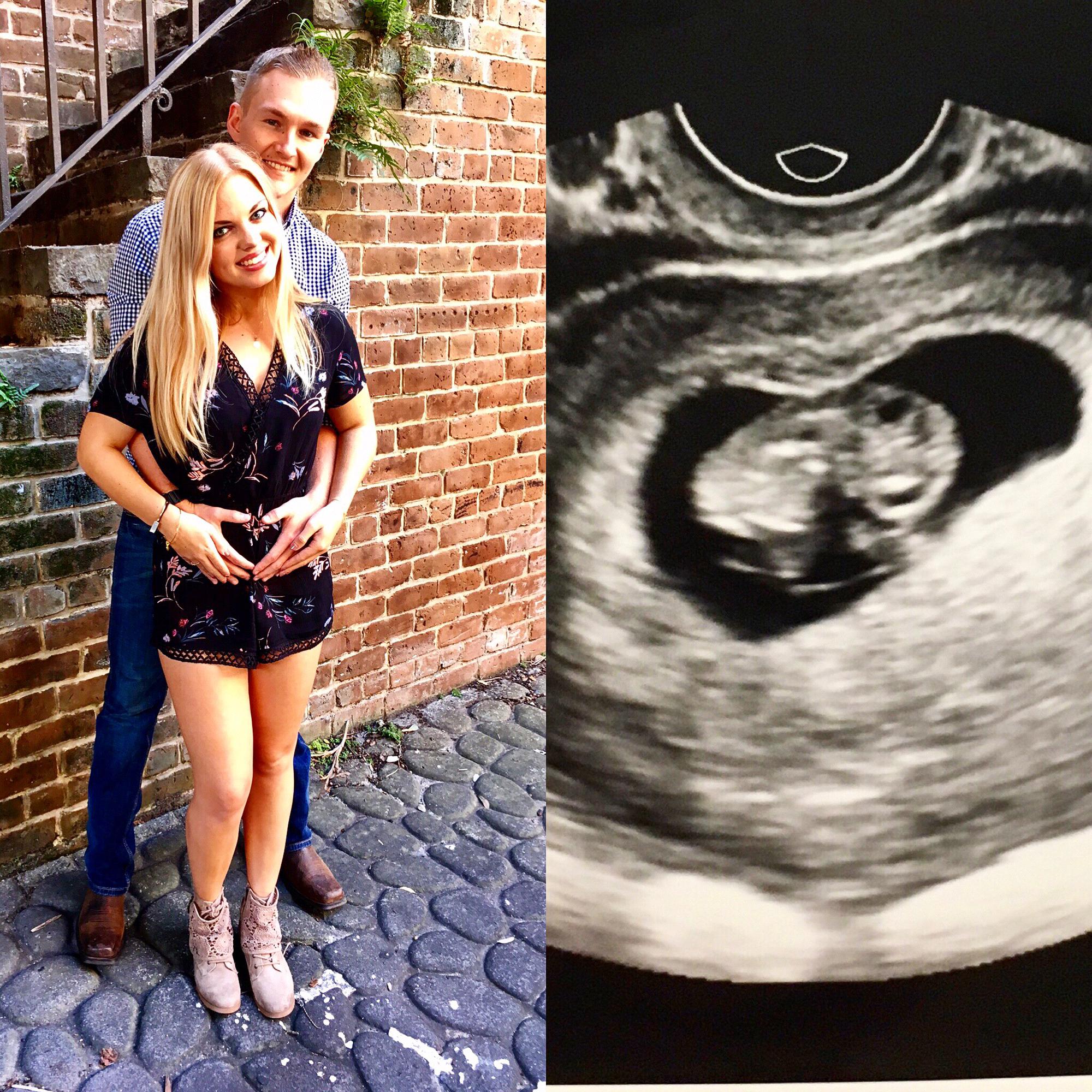 When we found out we were expecting!