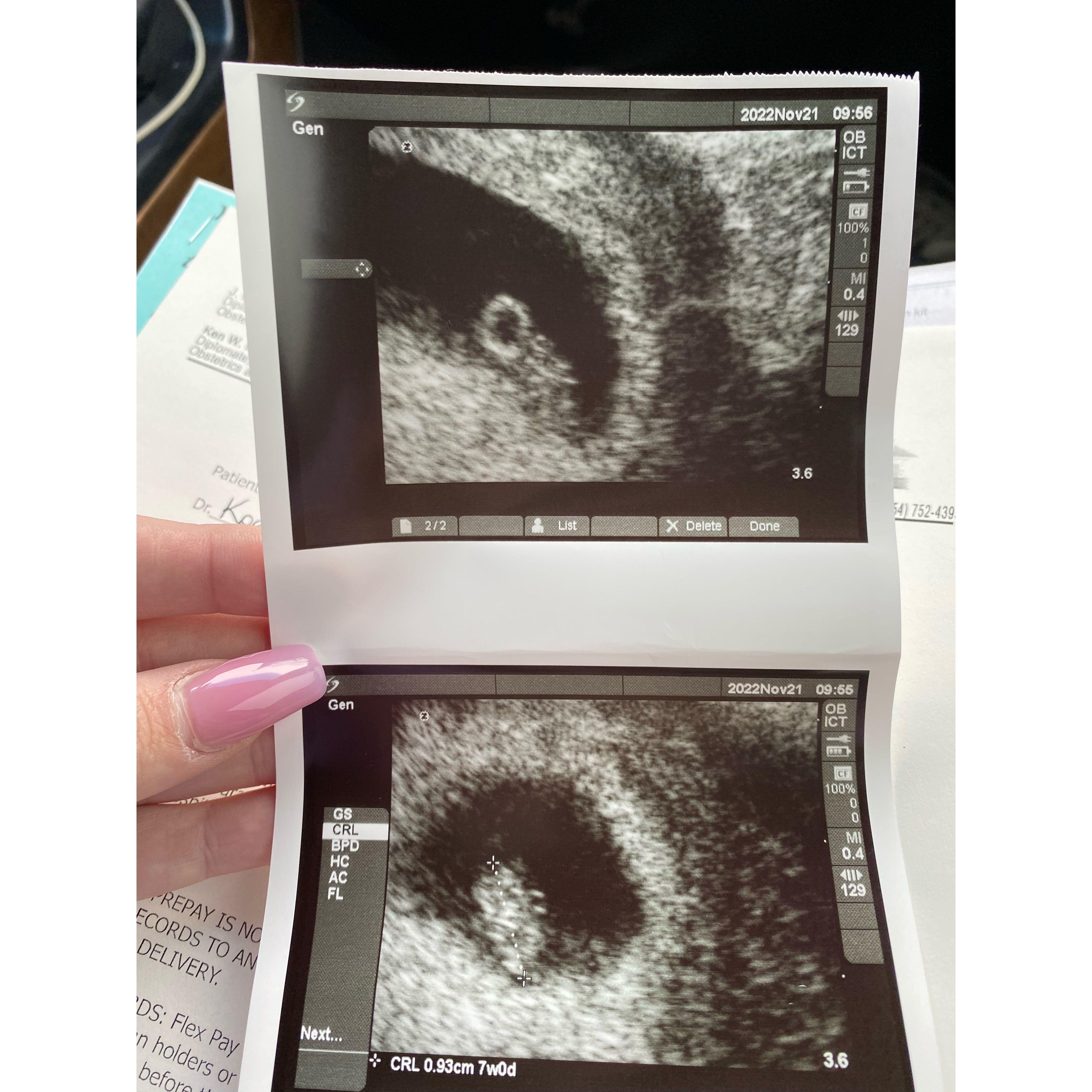 November 3, 2022: We found out we were having a baby!