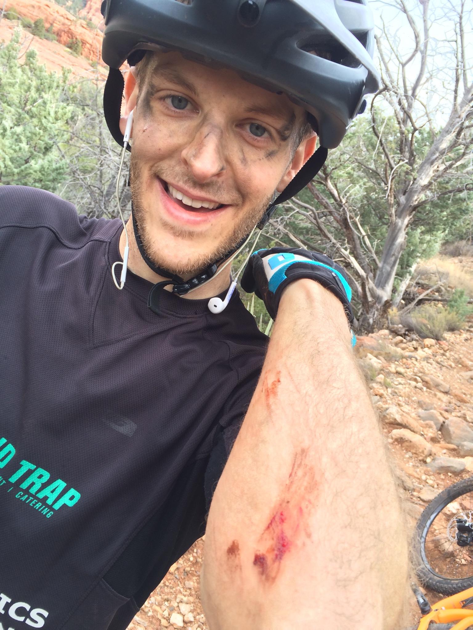 Jason doesn't fall nearly as much as Jenny does. But when he does, he draws blood!