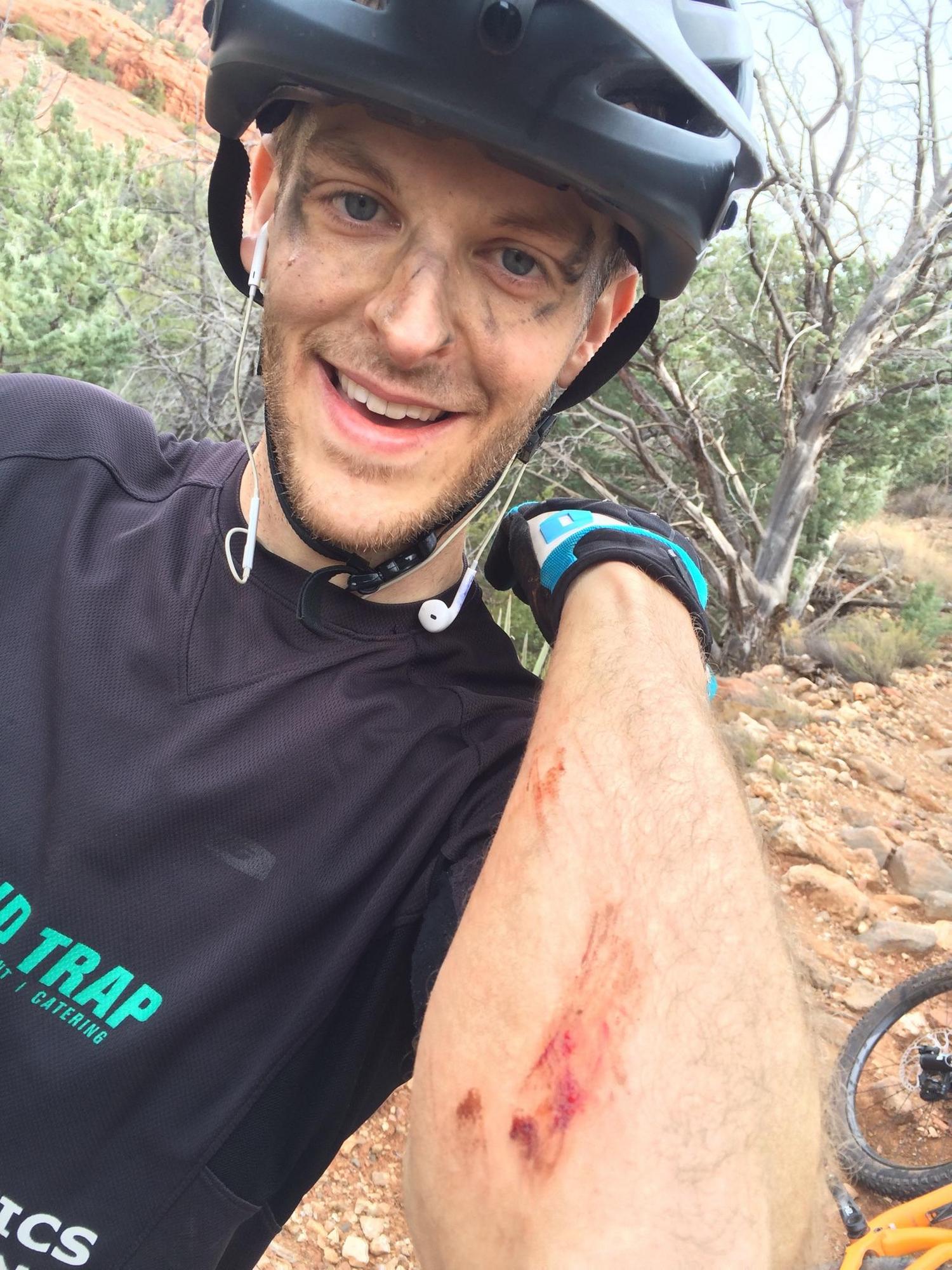 Jason doesn't fall nearly as much as Jenny does. But when he does, he draws blood!