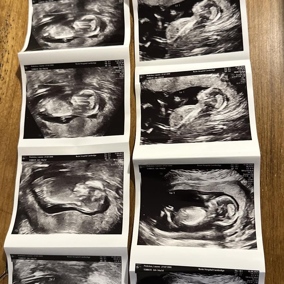 First ultrasound picture