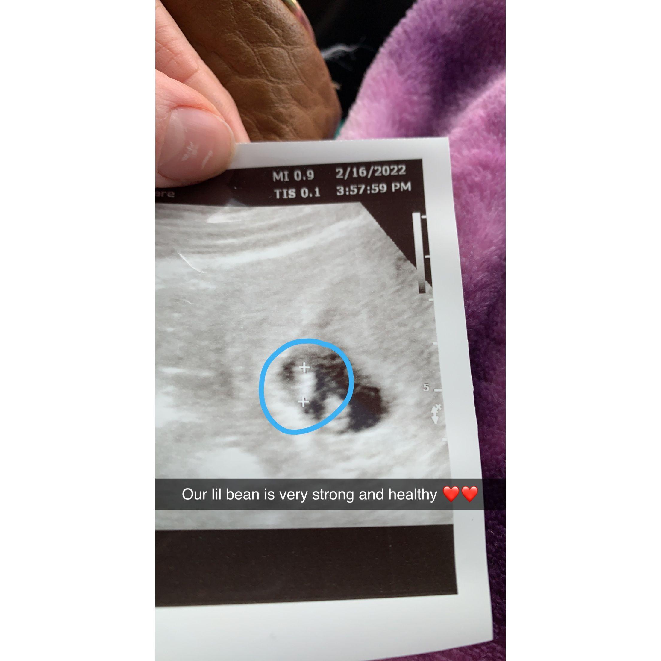 Our first ultra sound of Iris !