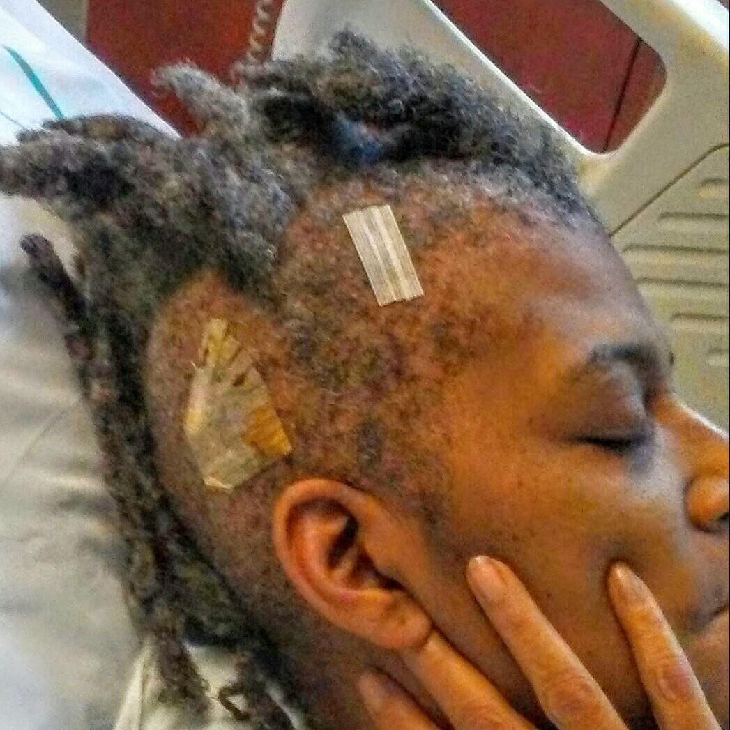 Cyteria in Neuro ICU at CMC after her brain aneurysm ruptured on January 17, 2017. You've come a long way, baby!