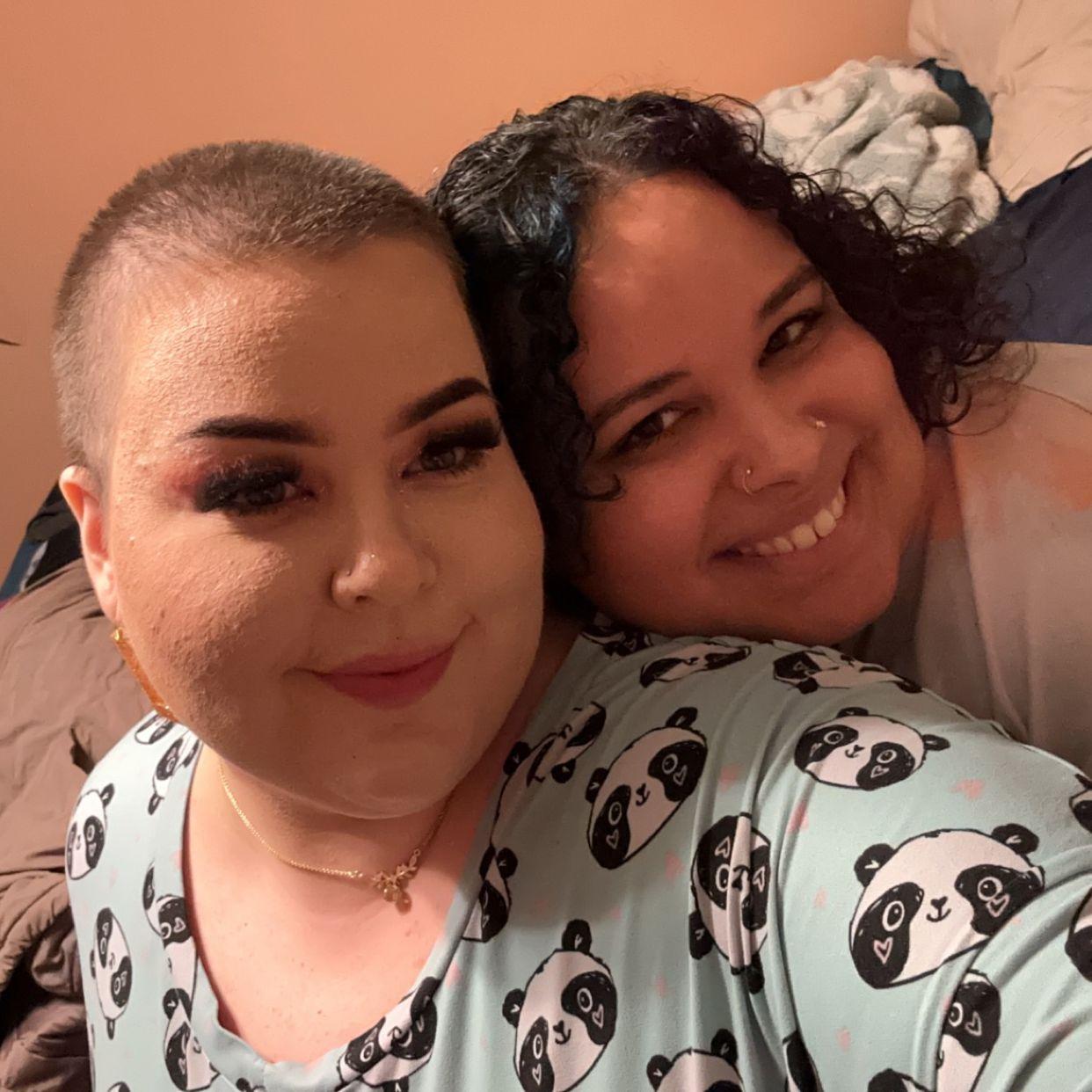 Selfie with my bald head when my hospital stay caused my hair to fall out and she stayed by my side every step of the way.
