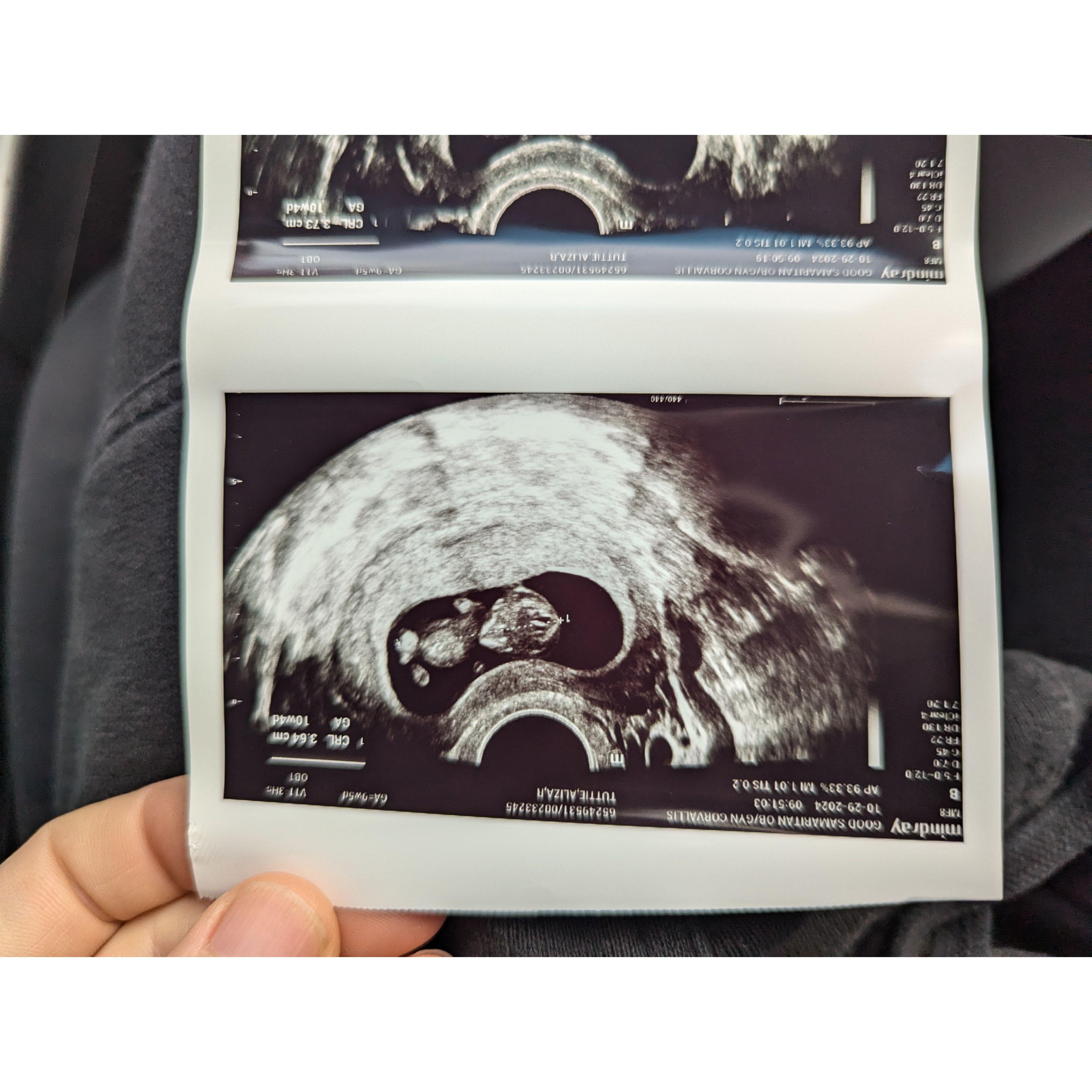 ... and our family! Baby Simmons expected May 2025!