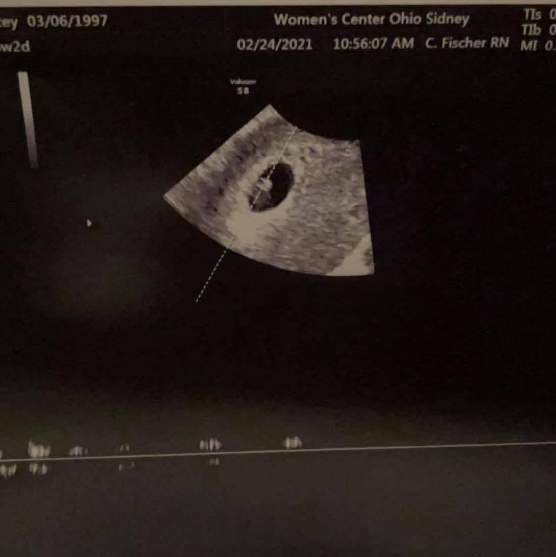 Found out we were pregnant with peanut 2021 (rest in heaven sweet baby)
