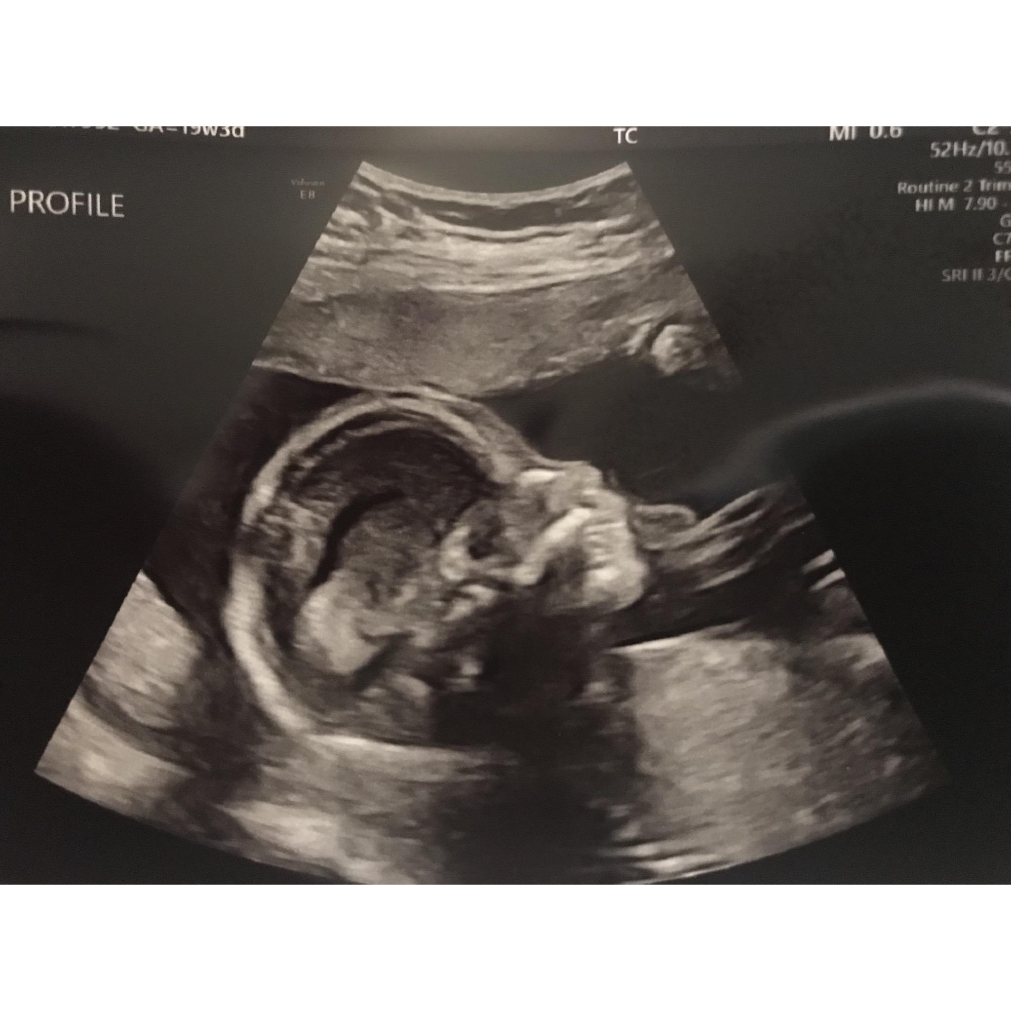First time seeing our beautiful Winnie Hutton.