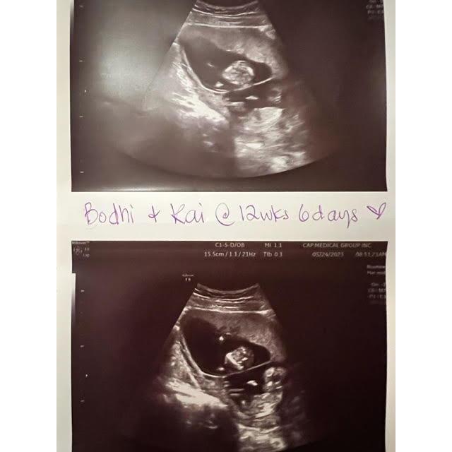 Our plan was always to have kids... the universe planned to give us TWO a little sooner than anticipated and we cannot be more thrilled! Eyler twin boys coming November 2023!