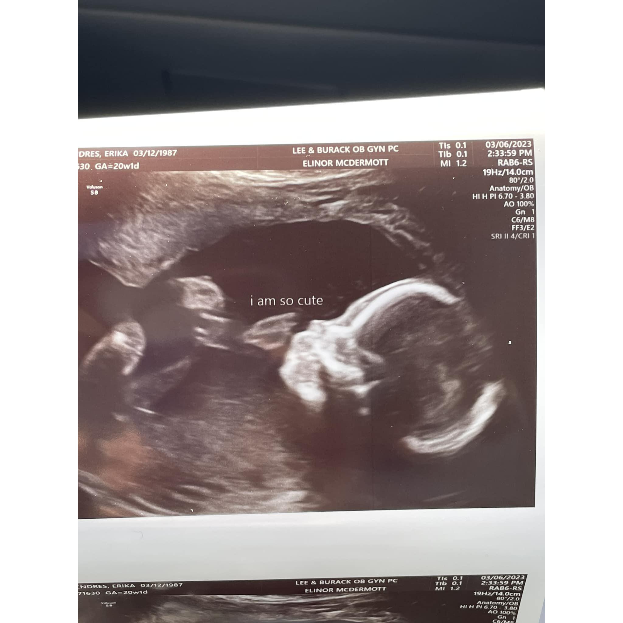 Wren at 20 weeks! IT'S A GIRL!! <3