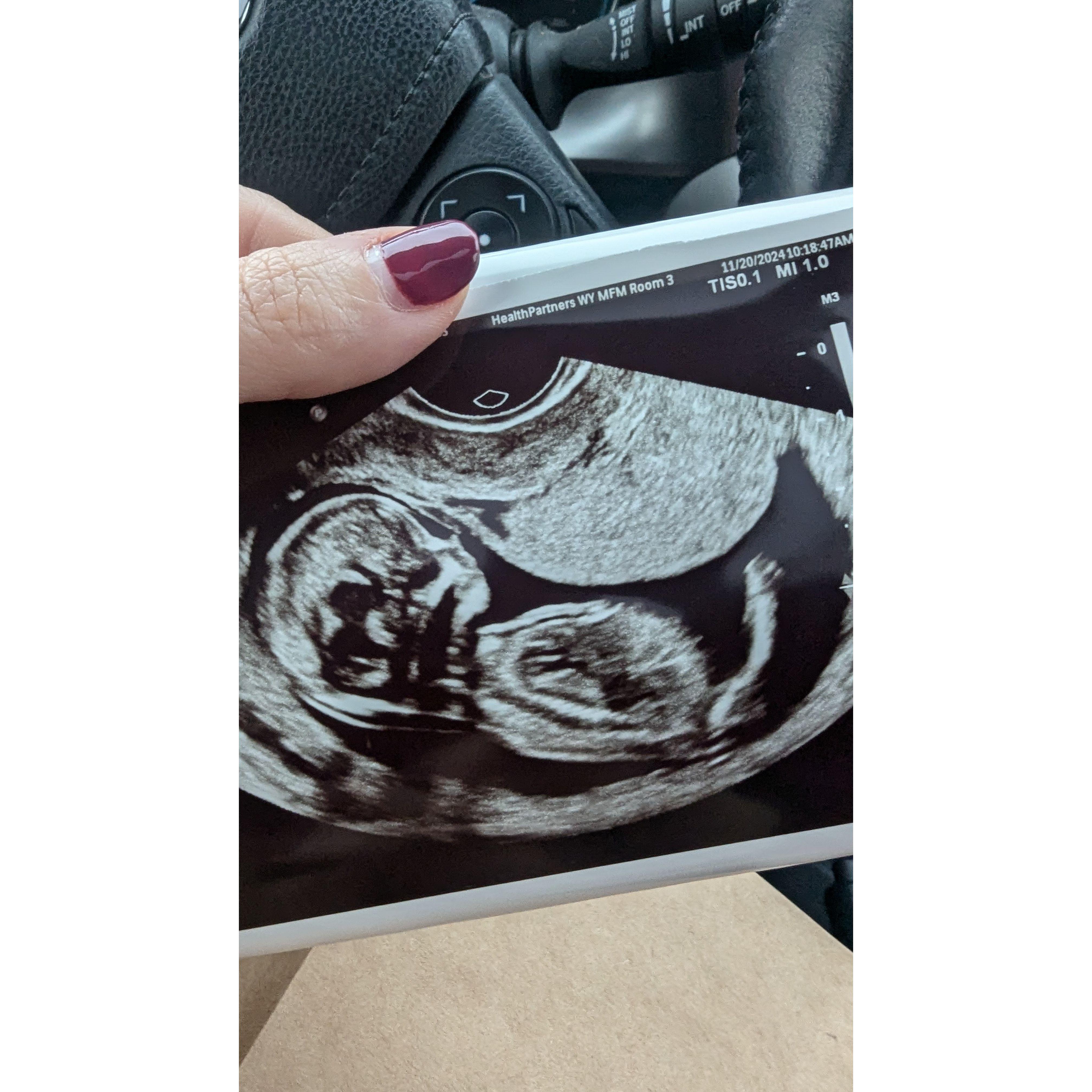 Hey Baby Girl