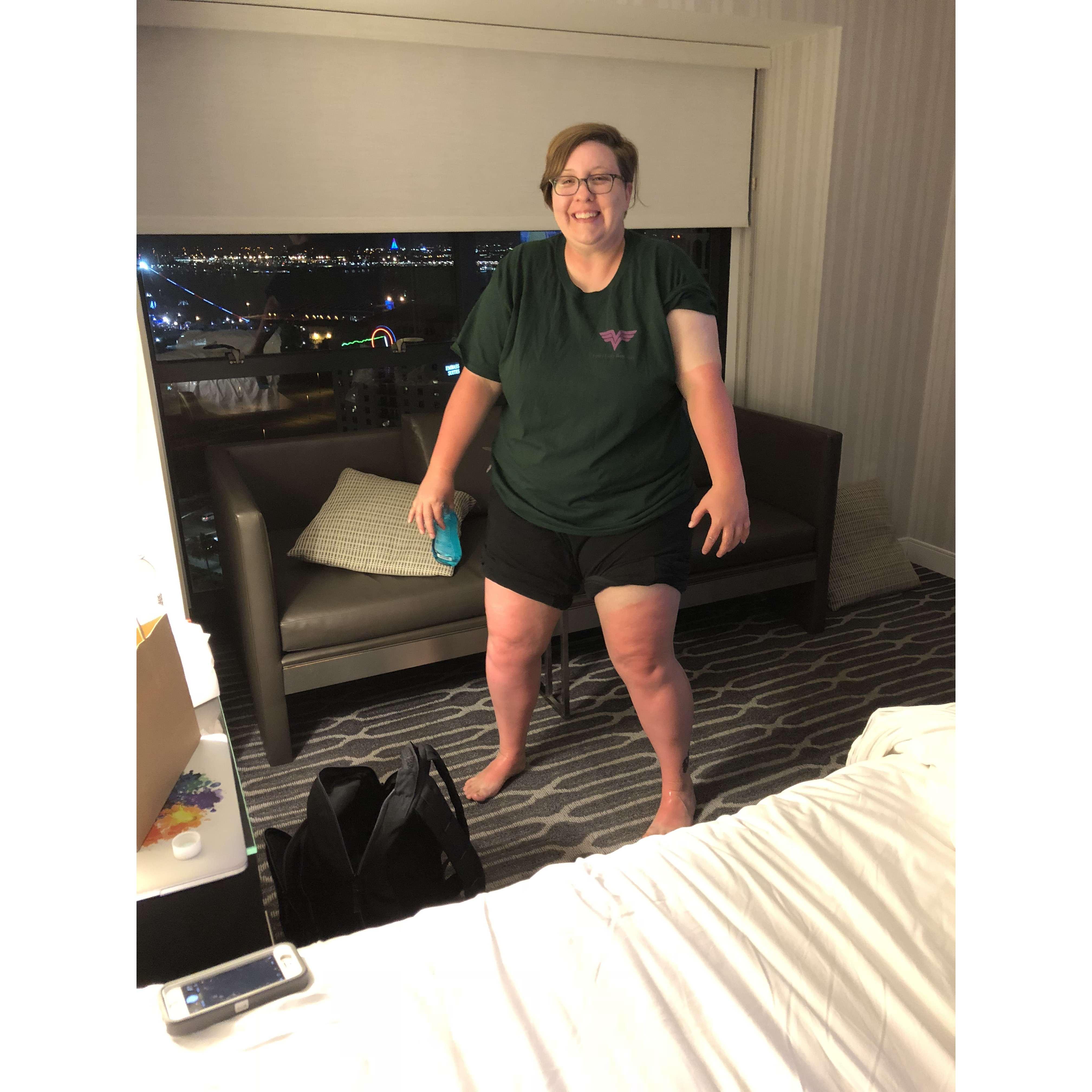 Maureen: I got extremely sunburnt in Sand Diego and Emmie wheeled me in the chair to the bathroom when I needed because it was so painful to walk.