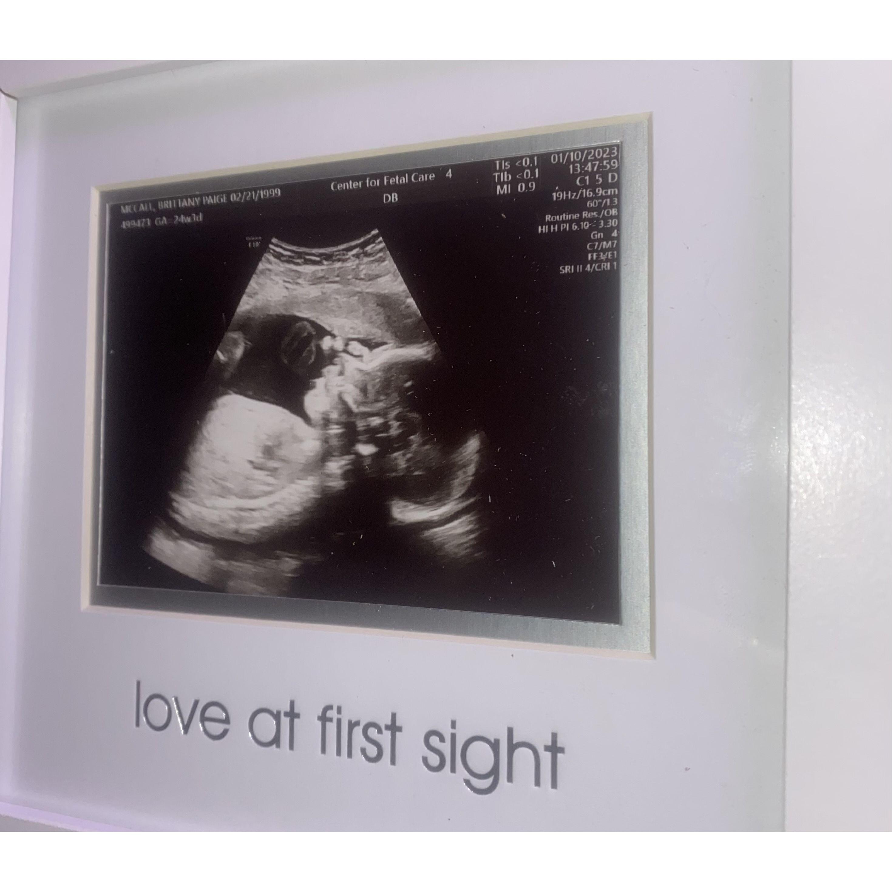 2nd anatomy scan - week ahead in size - 1lb 12 oz