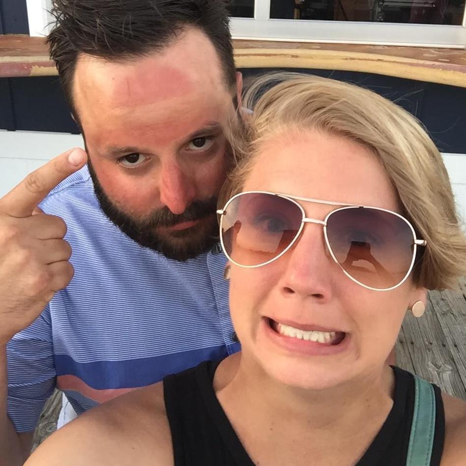 Sunrise sunburn 2018