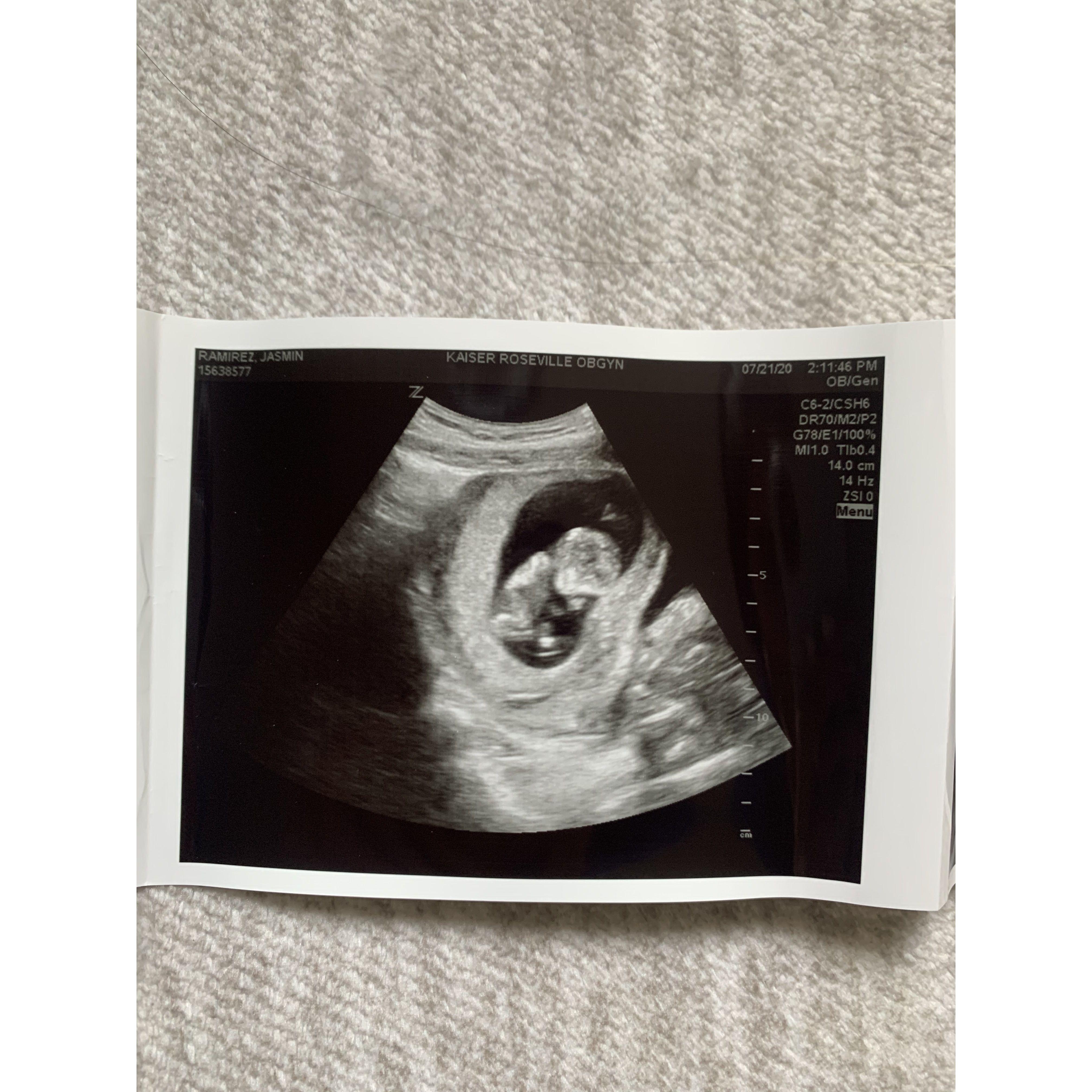 Sal and Jasmin decided to start a family first and in May 2020 they found out they were expecting.