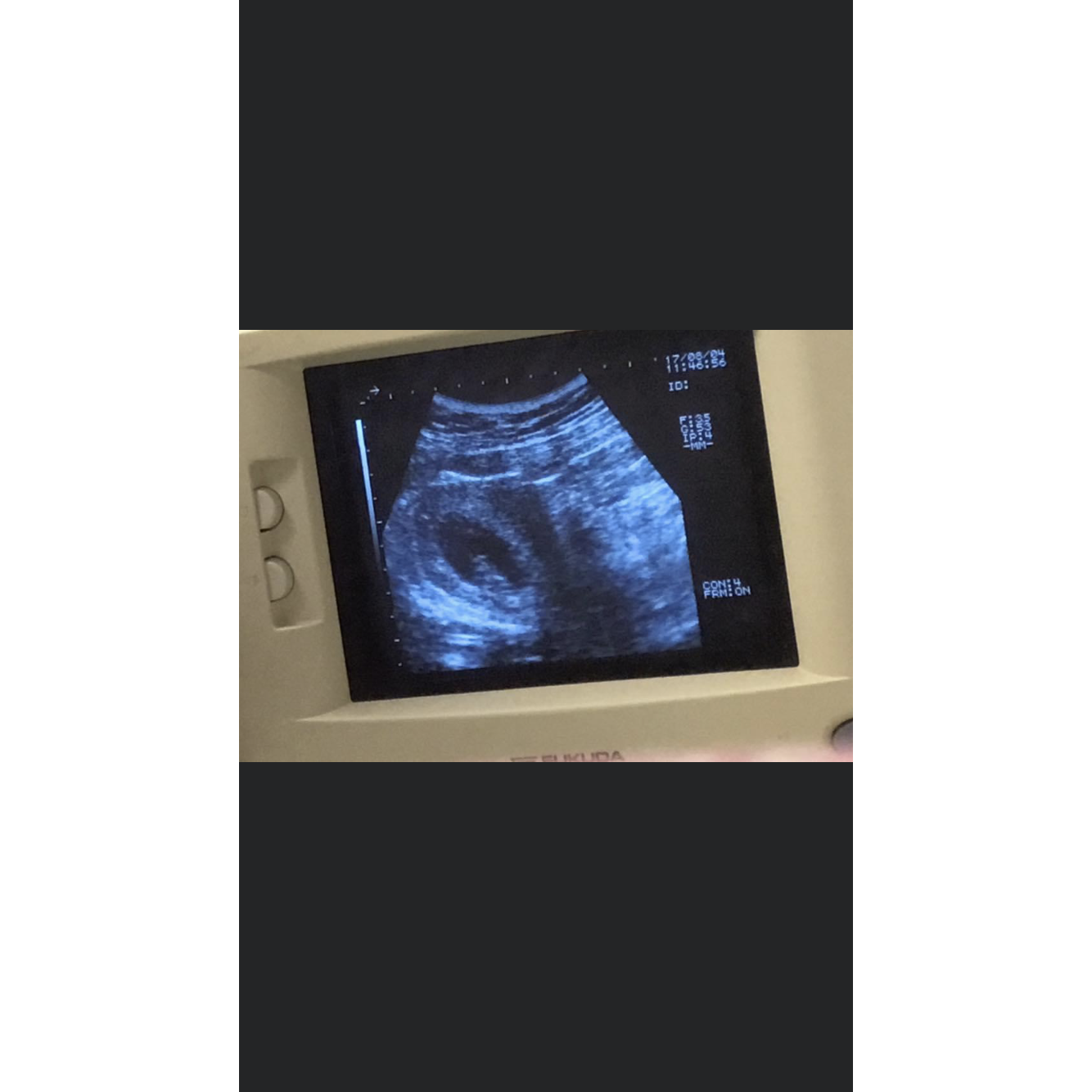 The first time seeing our little wiggle worm 😍
