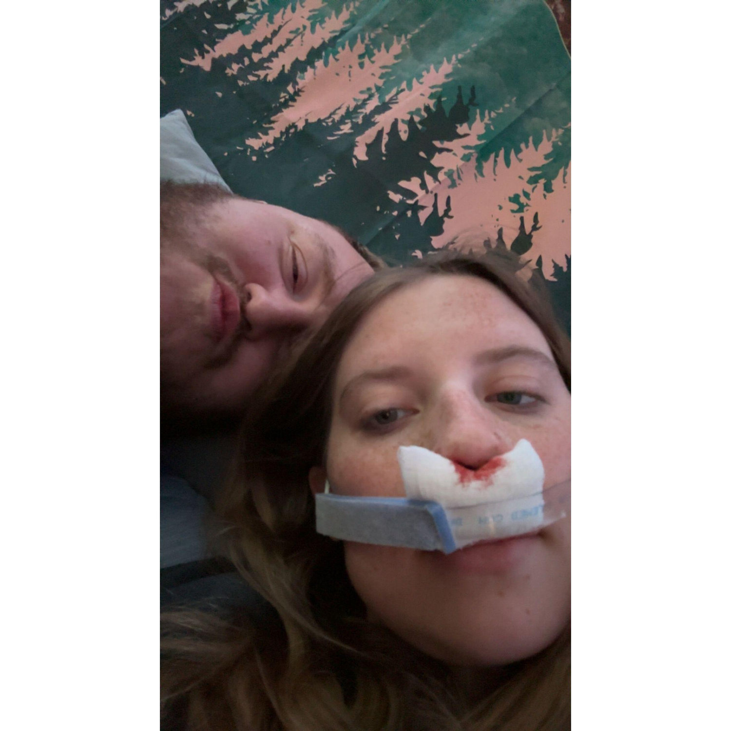 Austin cared for me throughout my entire healing process after my septoplasty surgery.